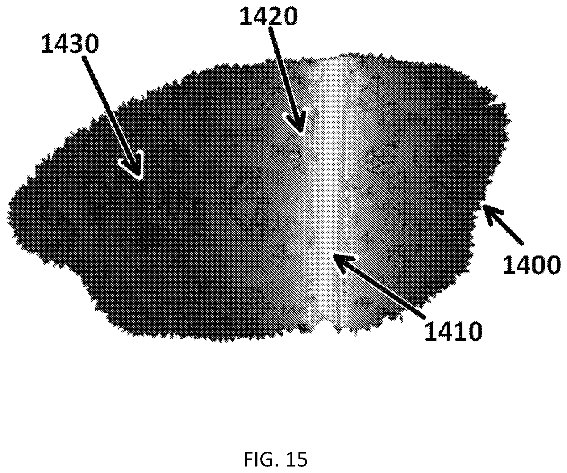 Patent US11771916 Figure 15 – Interstitial photodynamic therapy