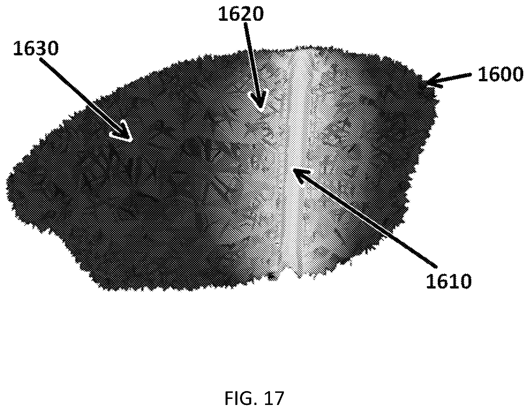 Patent US11771916 Figure 17 – Interstitial photodynamic therapy