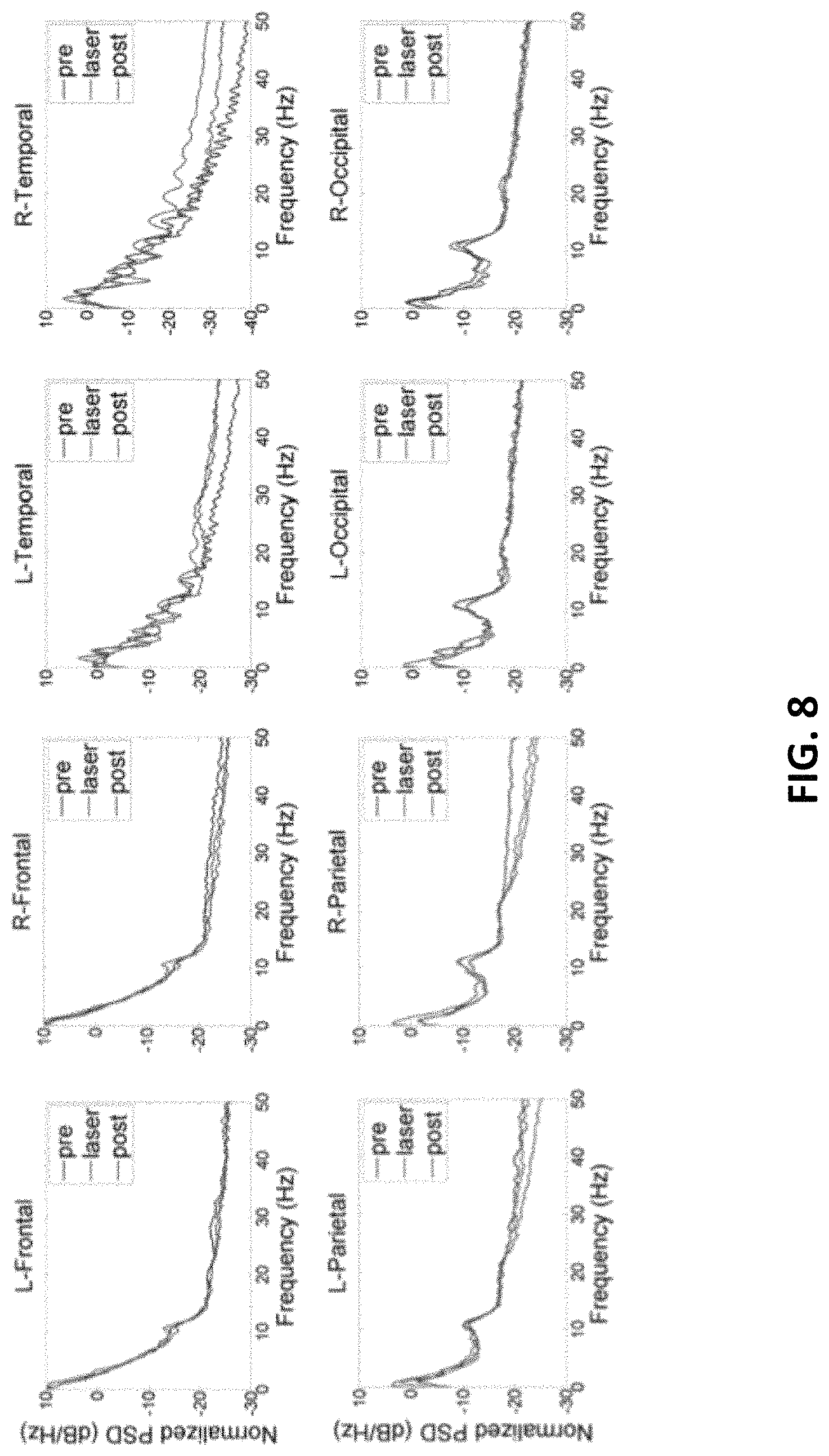 Patent US11771917 Figure 8 – Method and apparatus for brain function enhancement