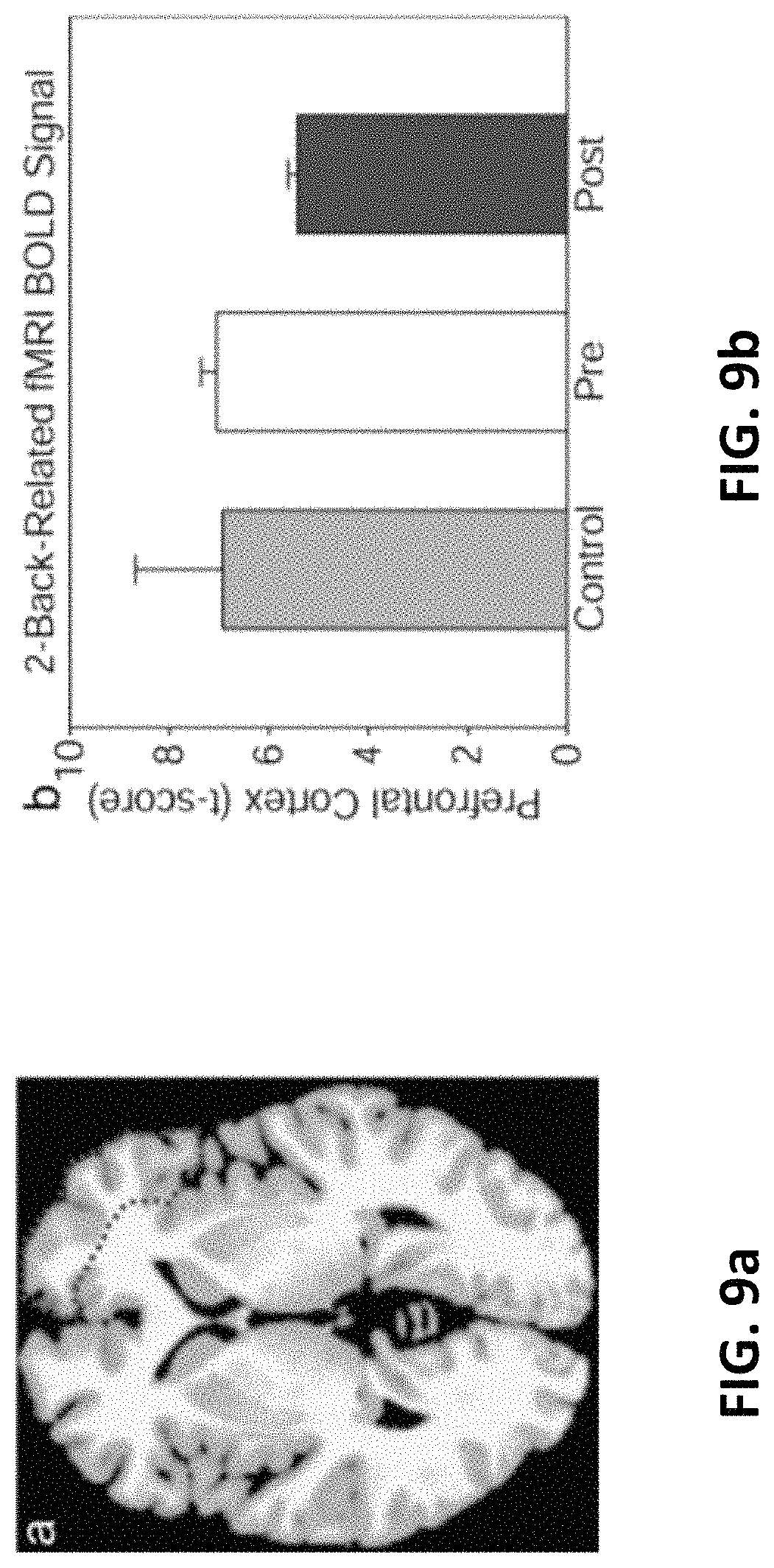 Patent US11771917 Figure 9 – Method and apparatus for brain function enhancement