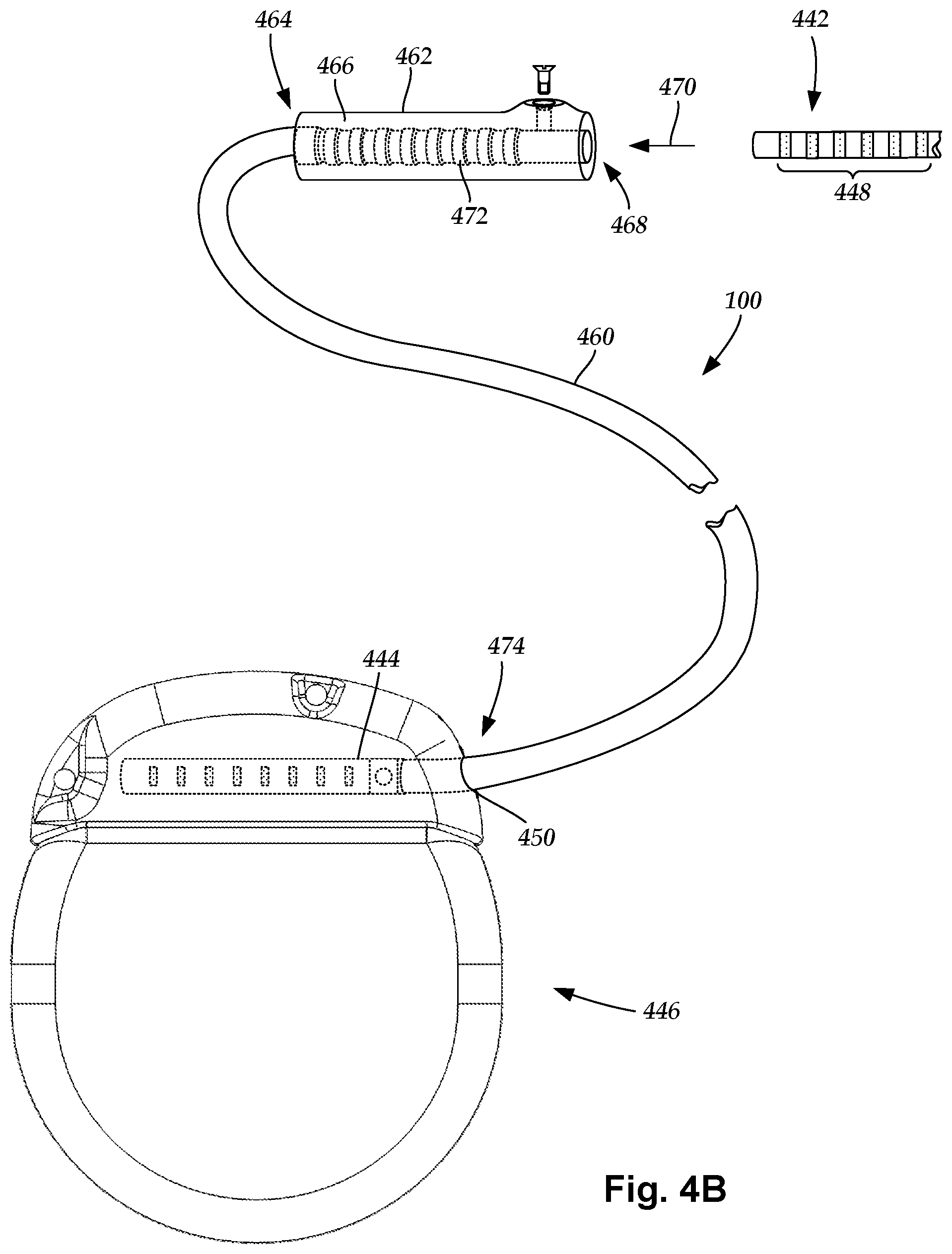 Patent US11771918 Figure 4 – Optical stimulation system with on-demand monitoring and methods of making and using