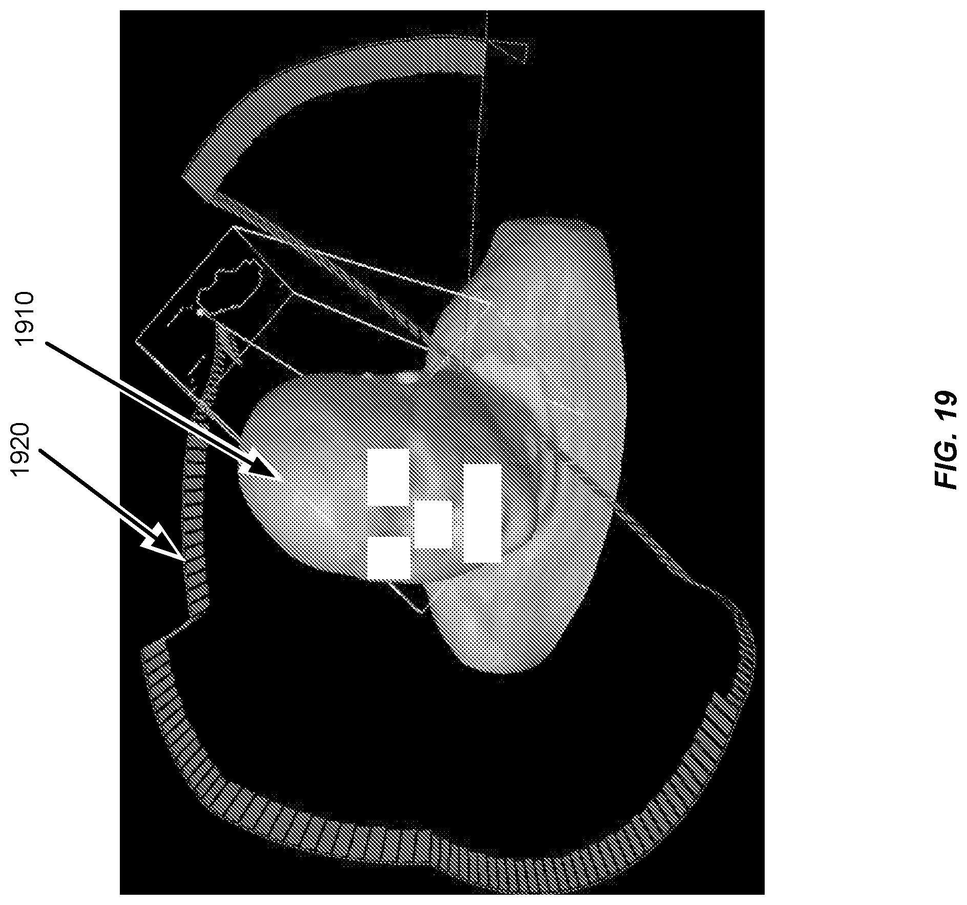 Patent US11771921 Figure 19 – Hybrid trajectory and beam angle optimization for external beam radiation therapy