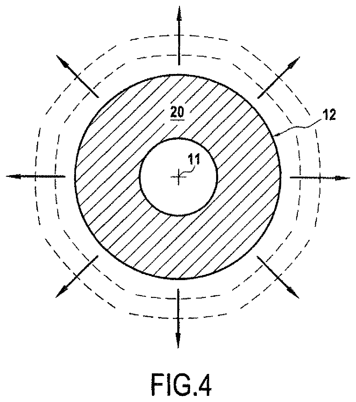 Patent US11771925 Figure 3 – Implantable ultrasound generating treating device for spinal cord and/or spinal nerve treatment, apparatus comprising such device and method