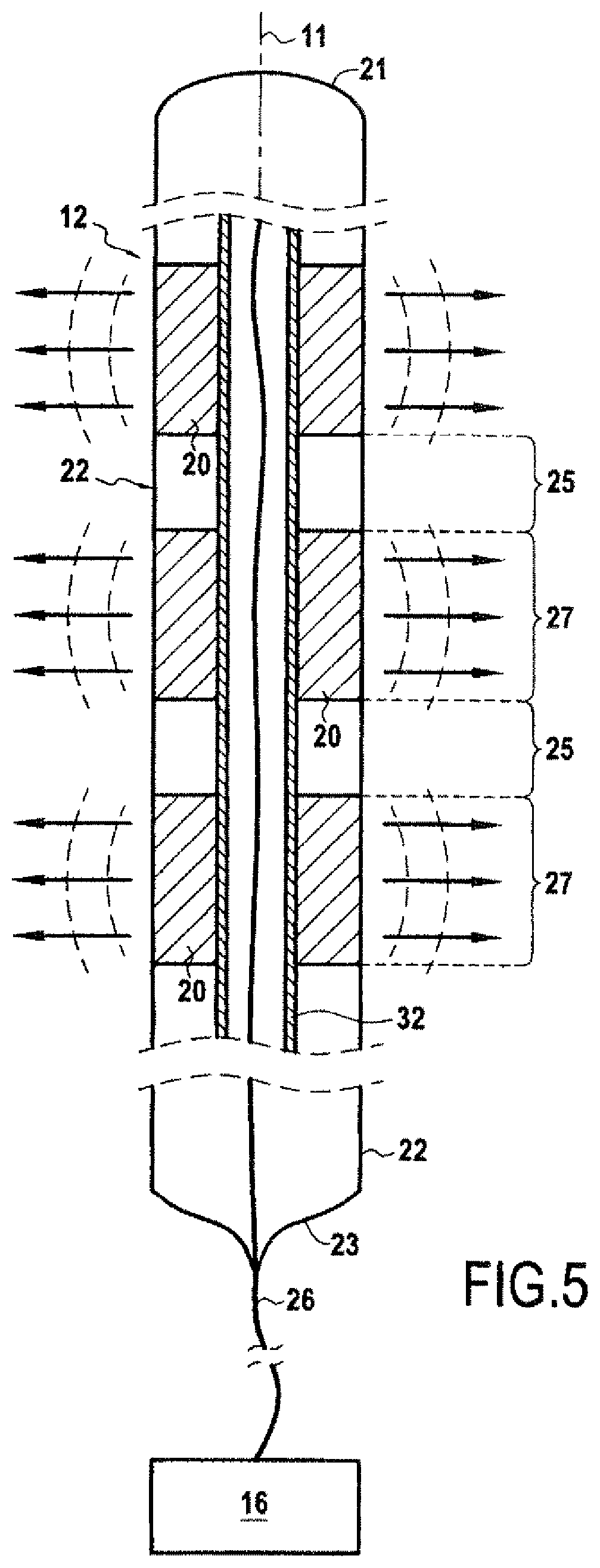 Patent US11771925 Figure 4 – Implantable ultrasound generating treating device for spinal cord and/or spinal nerve treatment, apparatus comprising such device and method