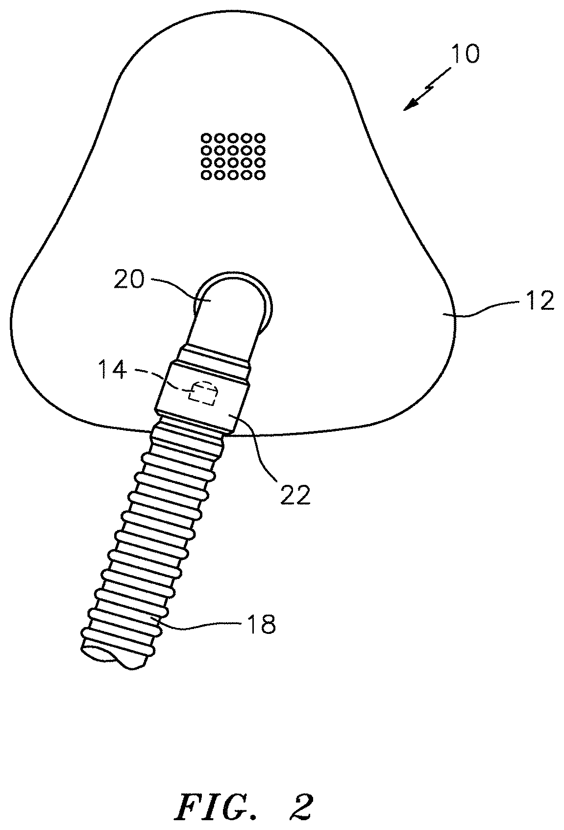 Patent US11771929 Figure 2 – Patient respiratory mask with integrated microphone and method of patient communication utilizing the same
