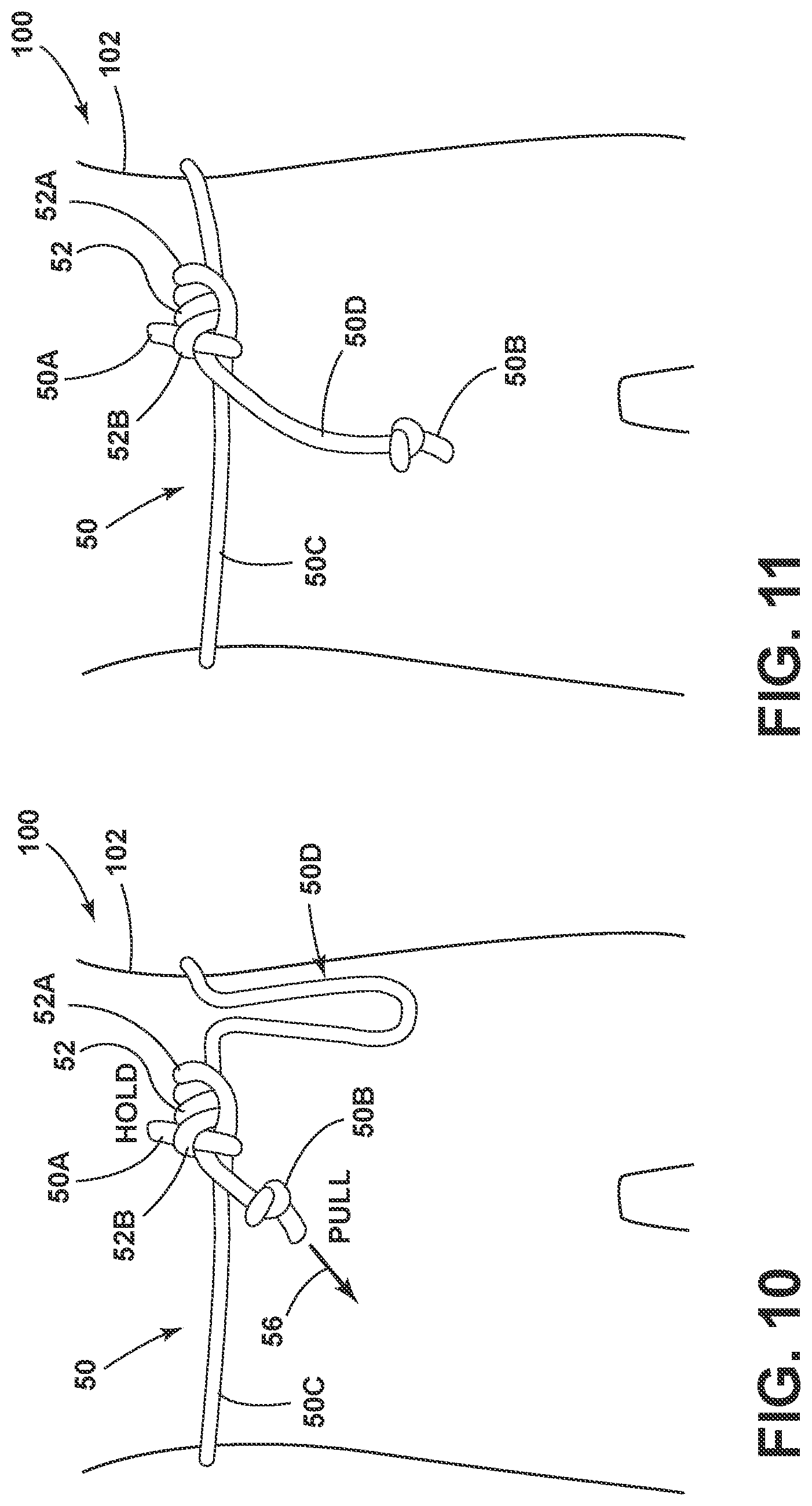 Patent US11771931 Figure 10 – Tree saddle