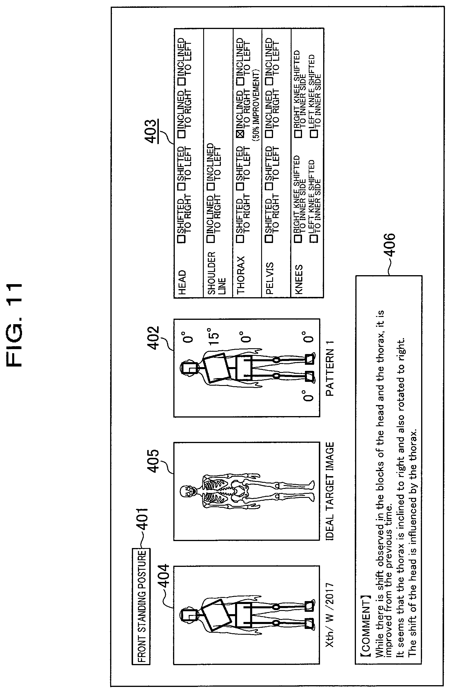 Patent US11771958 Figure 11 – Instructing process management system for treatment and/or exercise, and program, computer apparatus and method for managing instructing process for treatment and/or exercise