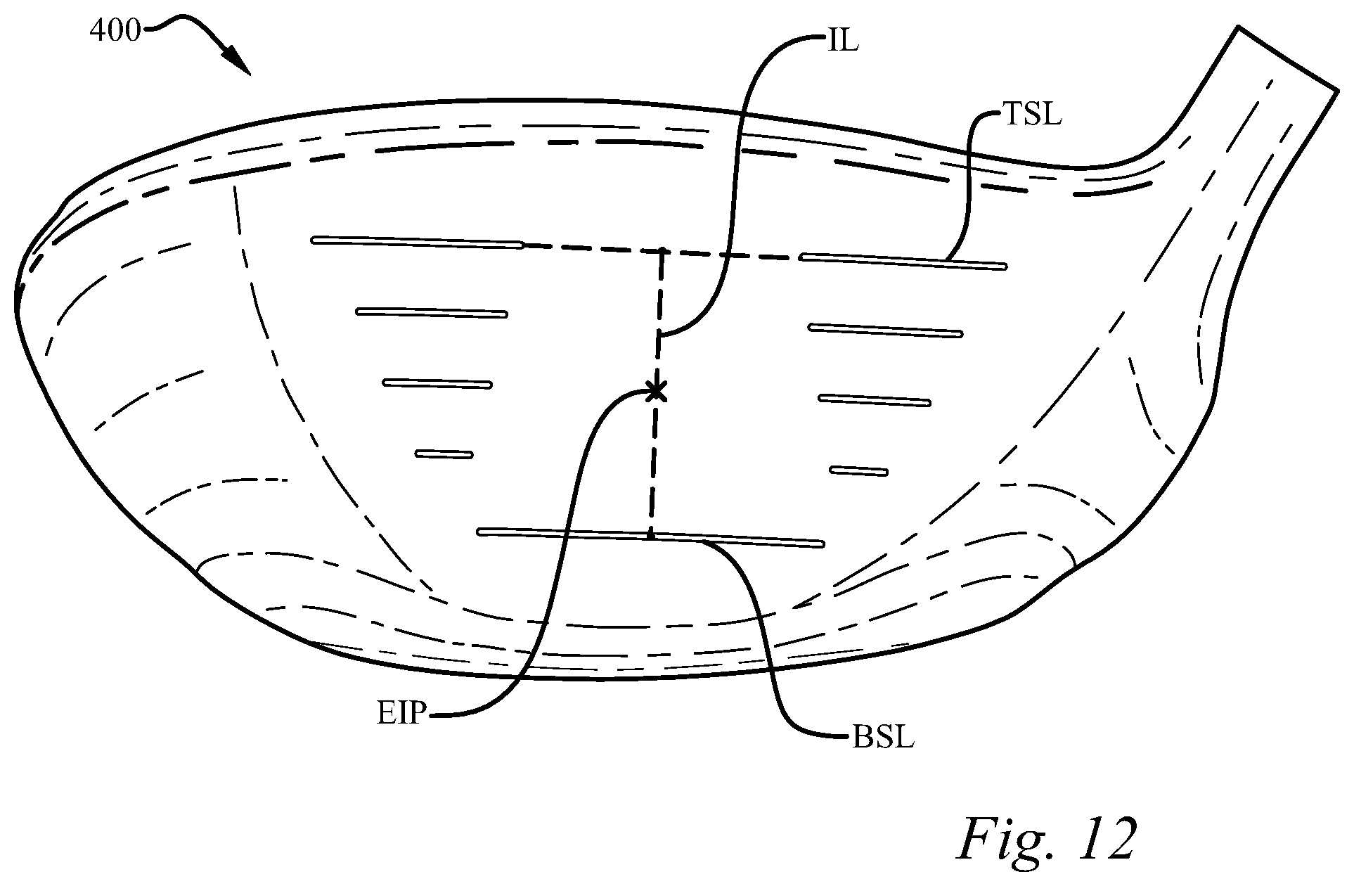 Patent US11771964 Figure 6 – Multi-material iron-type golf club head