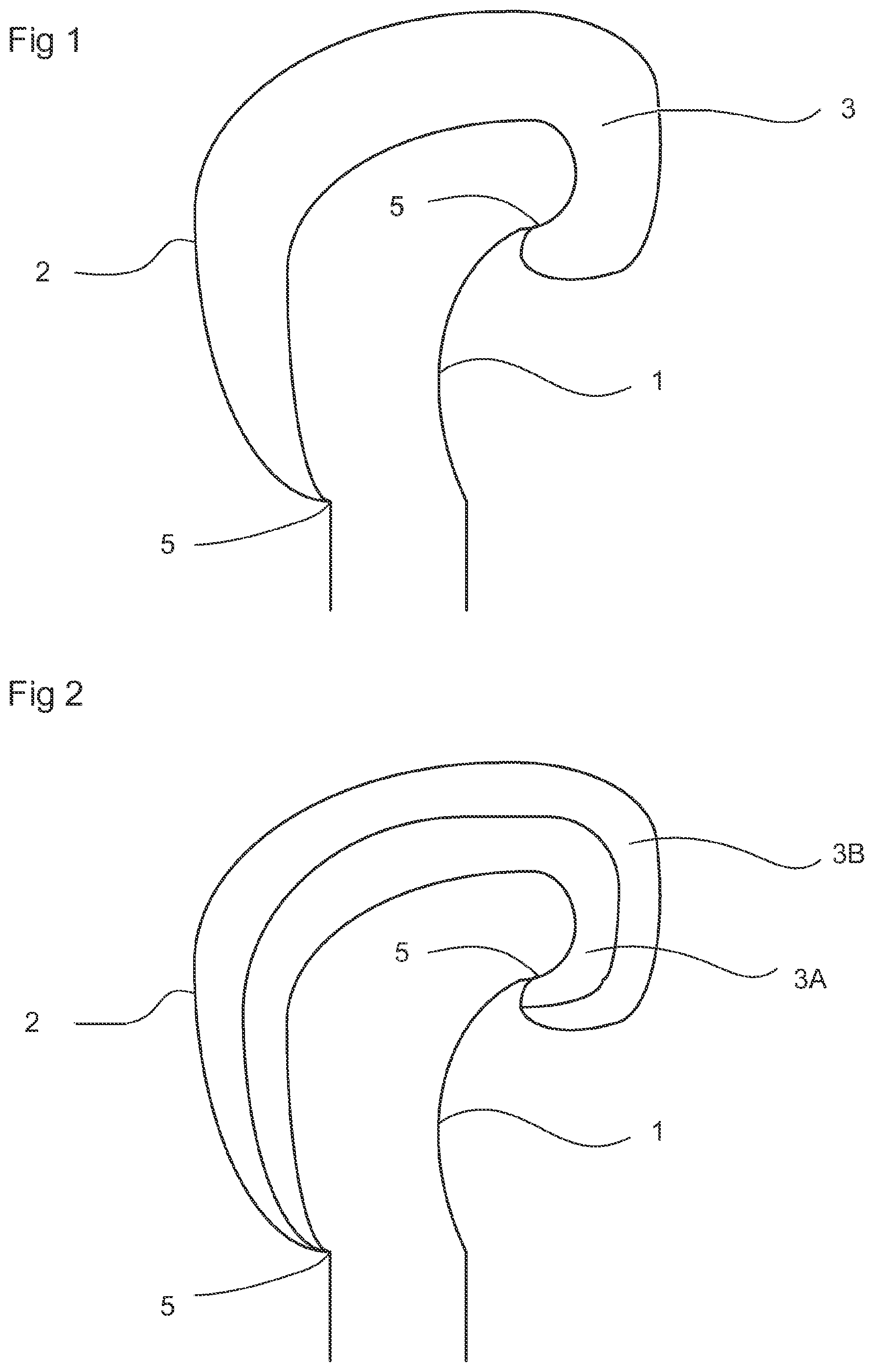 Patent US11771979 Figure 1 – Glove