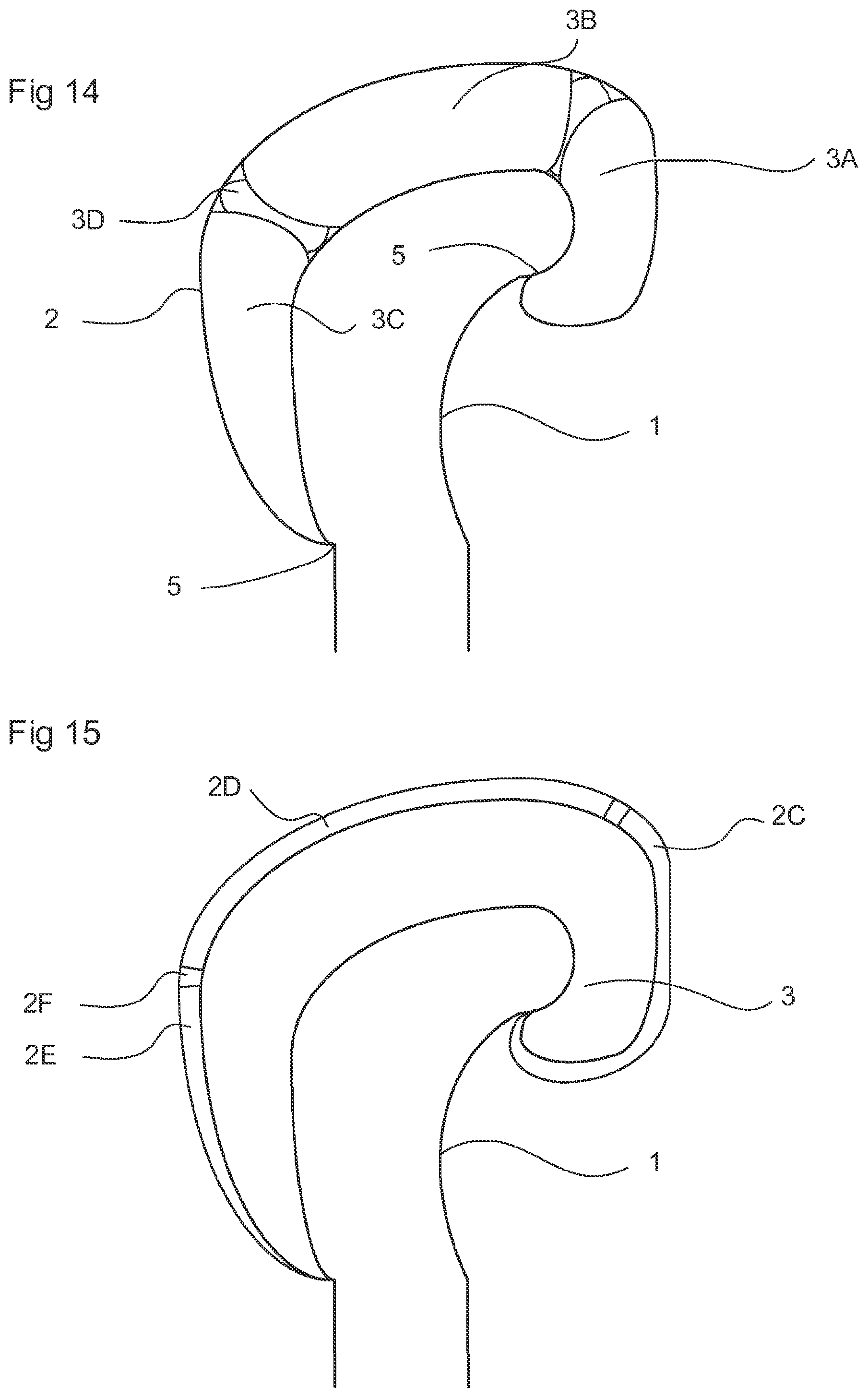 Patent US11771979 Figure 6 – Glove
