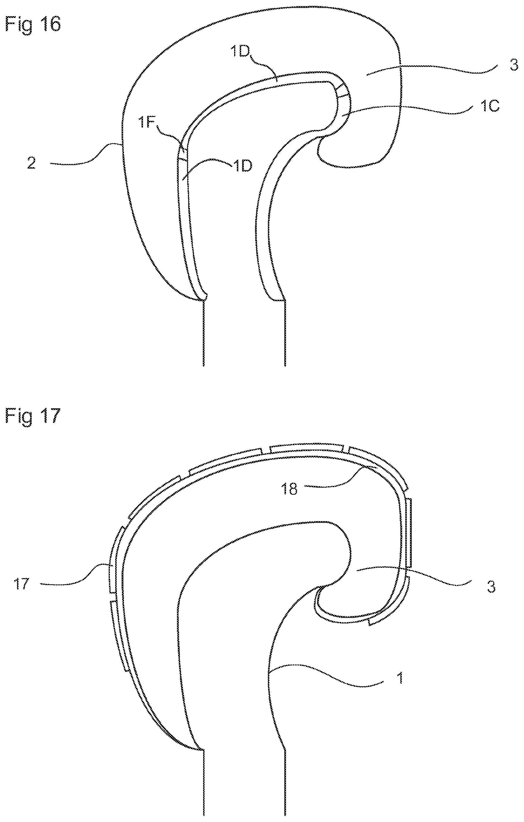 Patent US11771979 Figure 7 – Glove