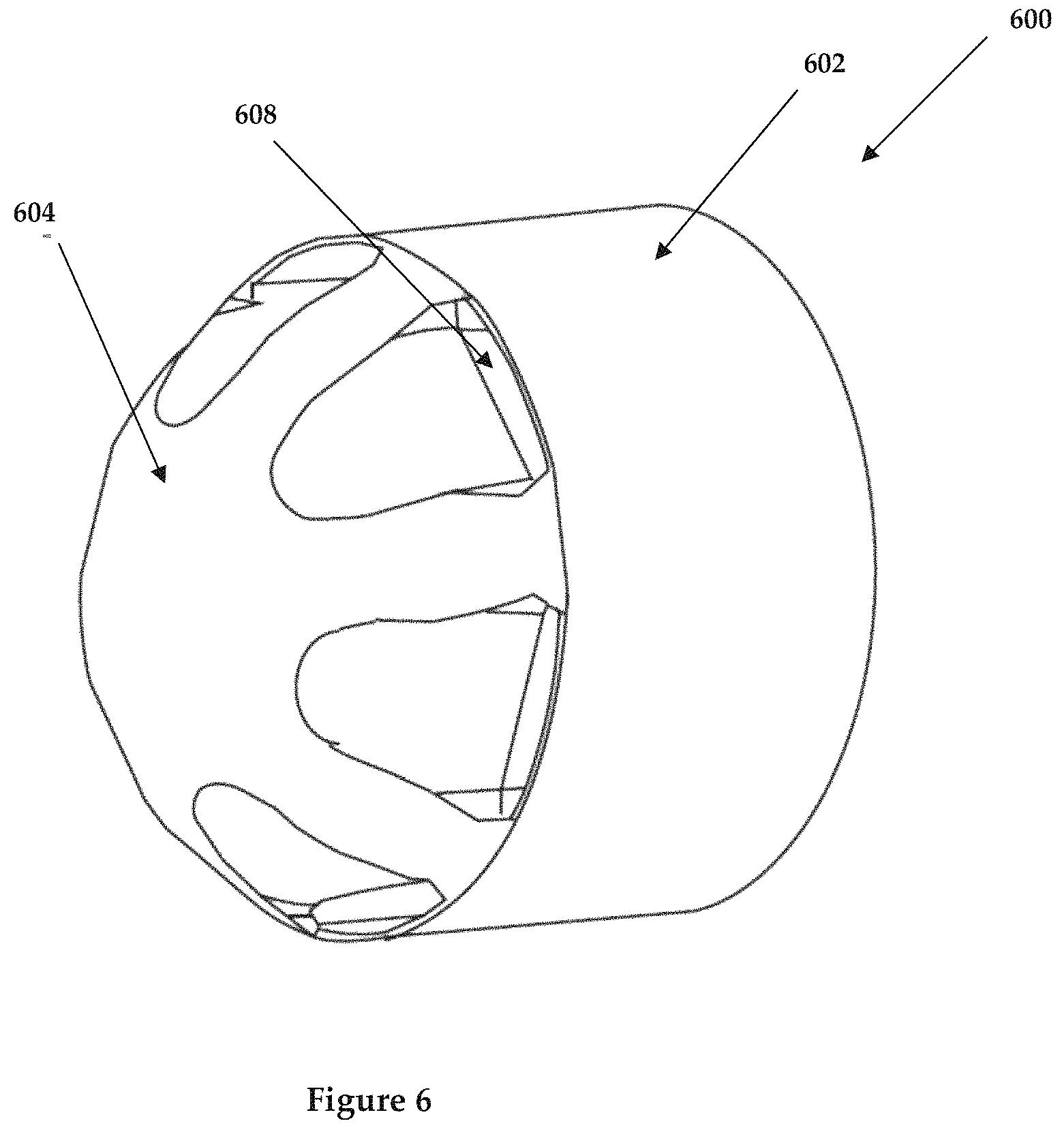 Patent US11772079 Figure 5 – Diesel particulate filtration (DPF) system