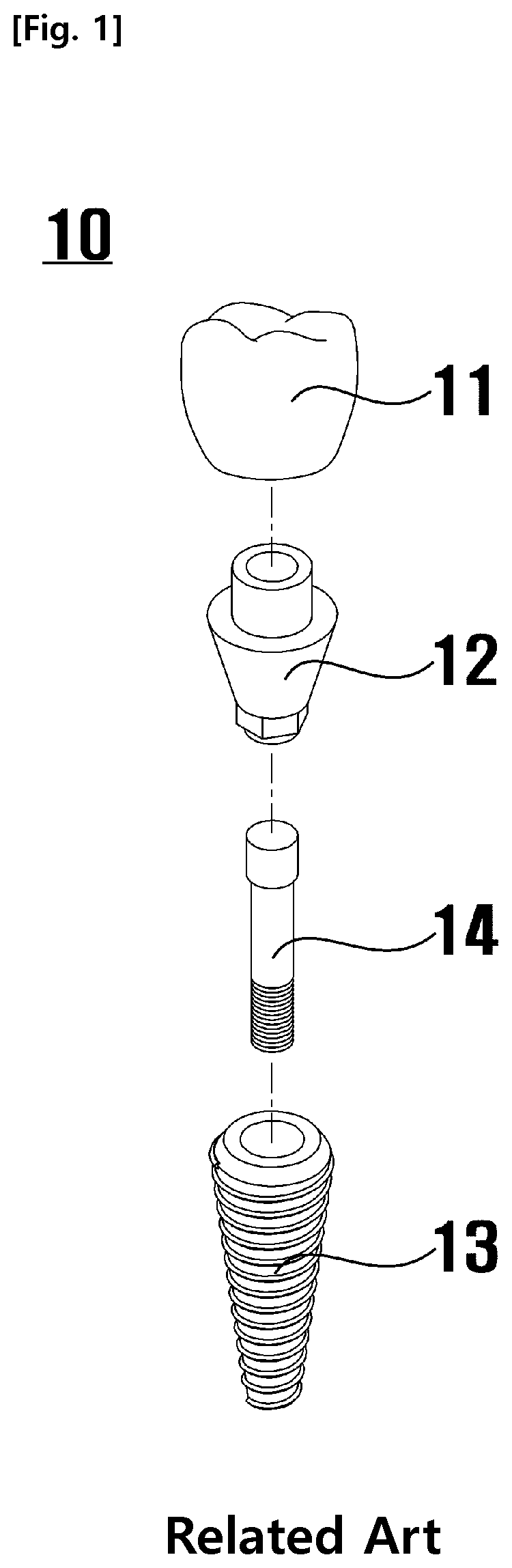 Patent US11772133 Figure 1 – Method for removing residual acid of implant