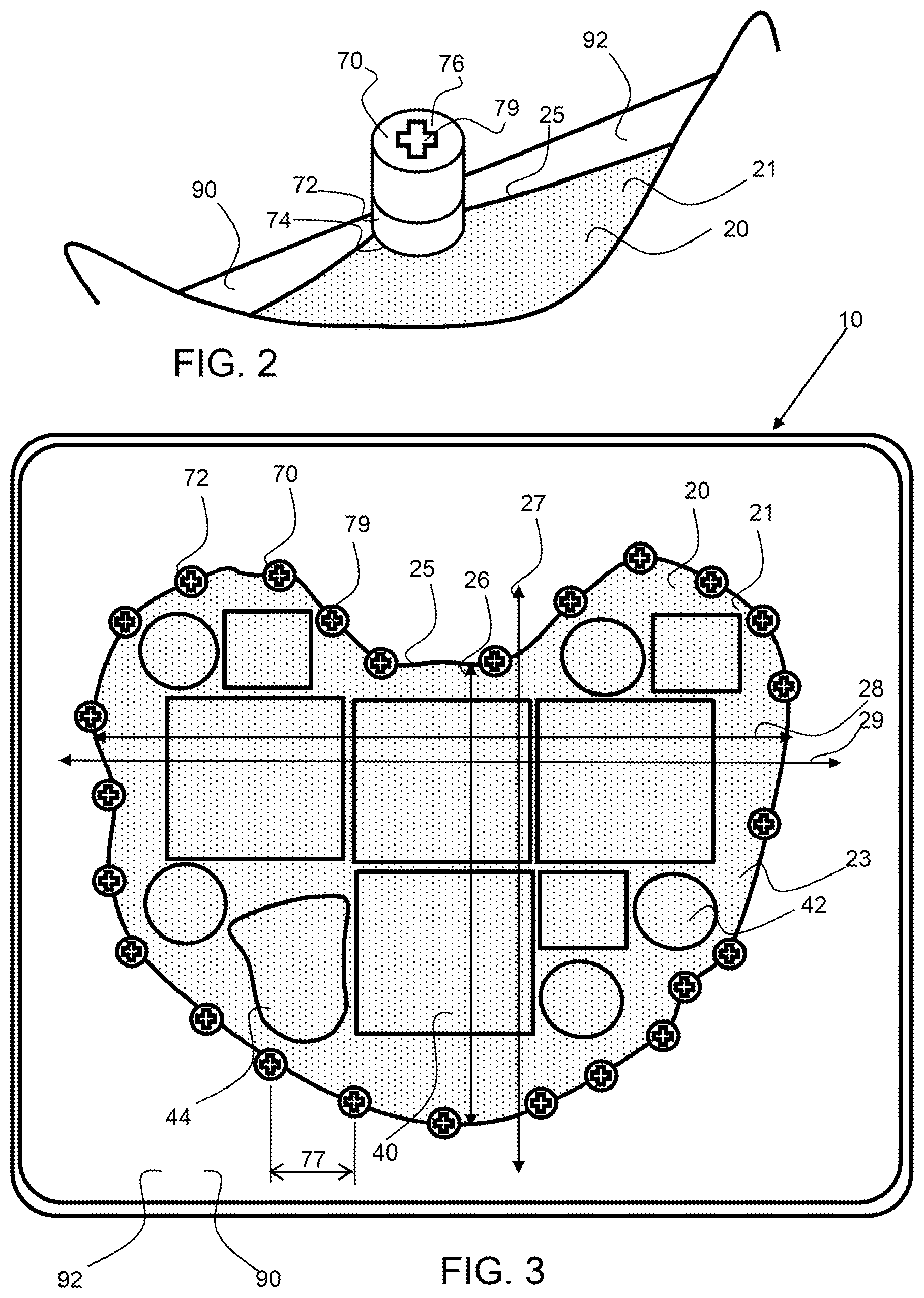 Patent US11772200 Figure 2 – Allograft optimization system