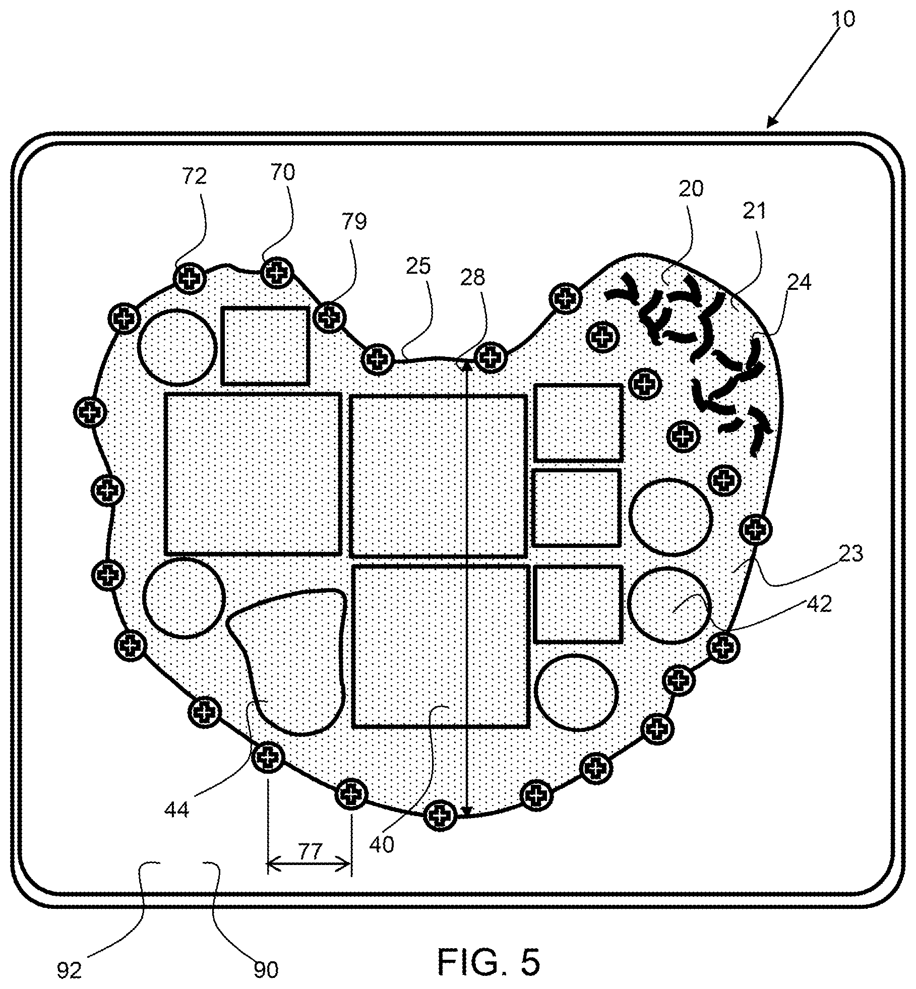 Patent US11772200 Figure 4 – Allograft optimization system
