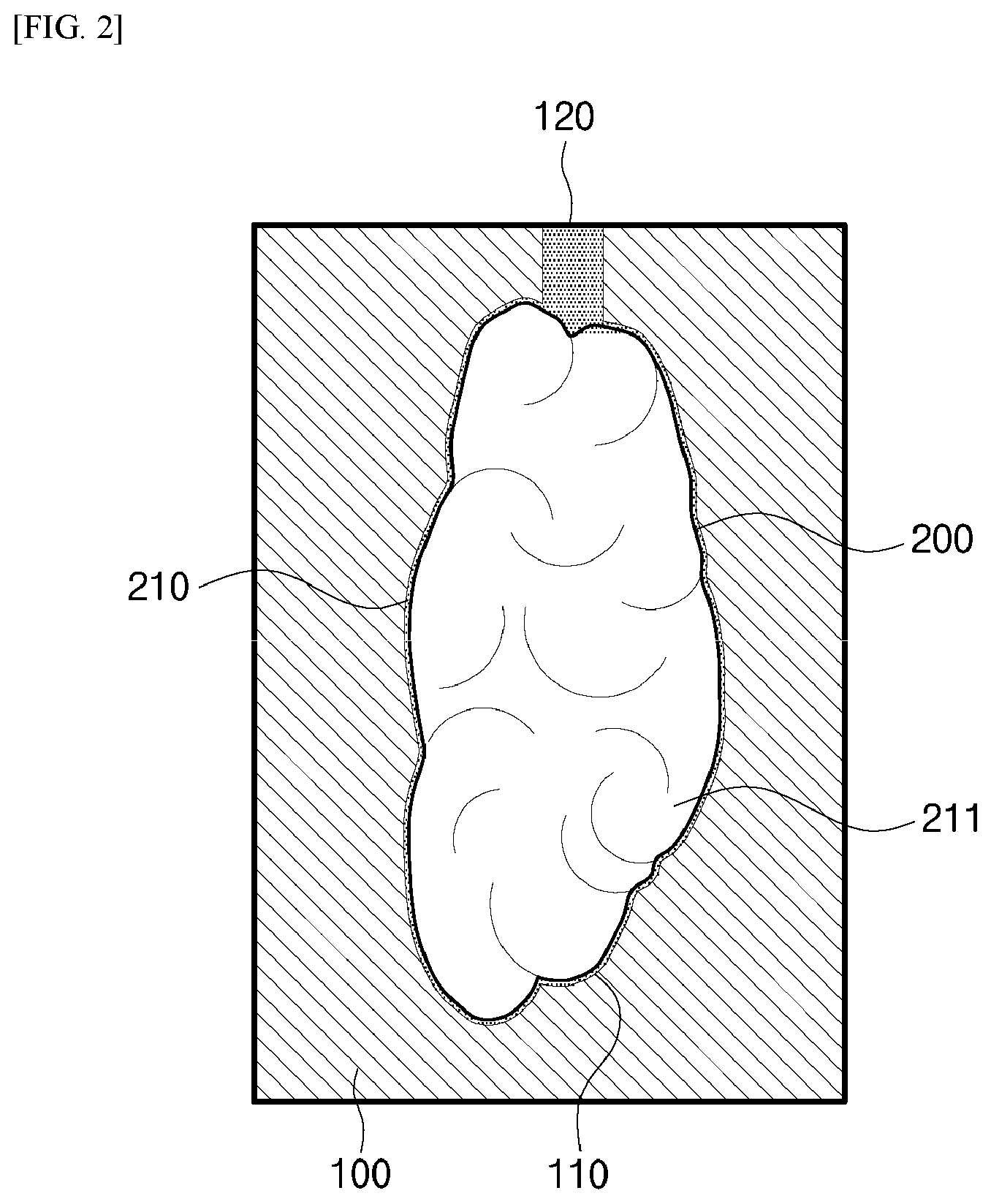 Patent US11772304 Figure 2 – Implant for implantation into human body and manufacturing method thereof