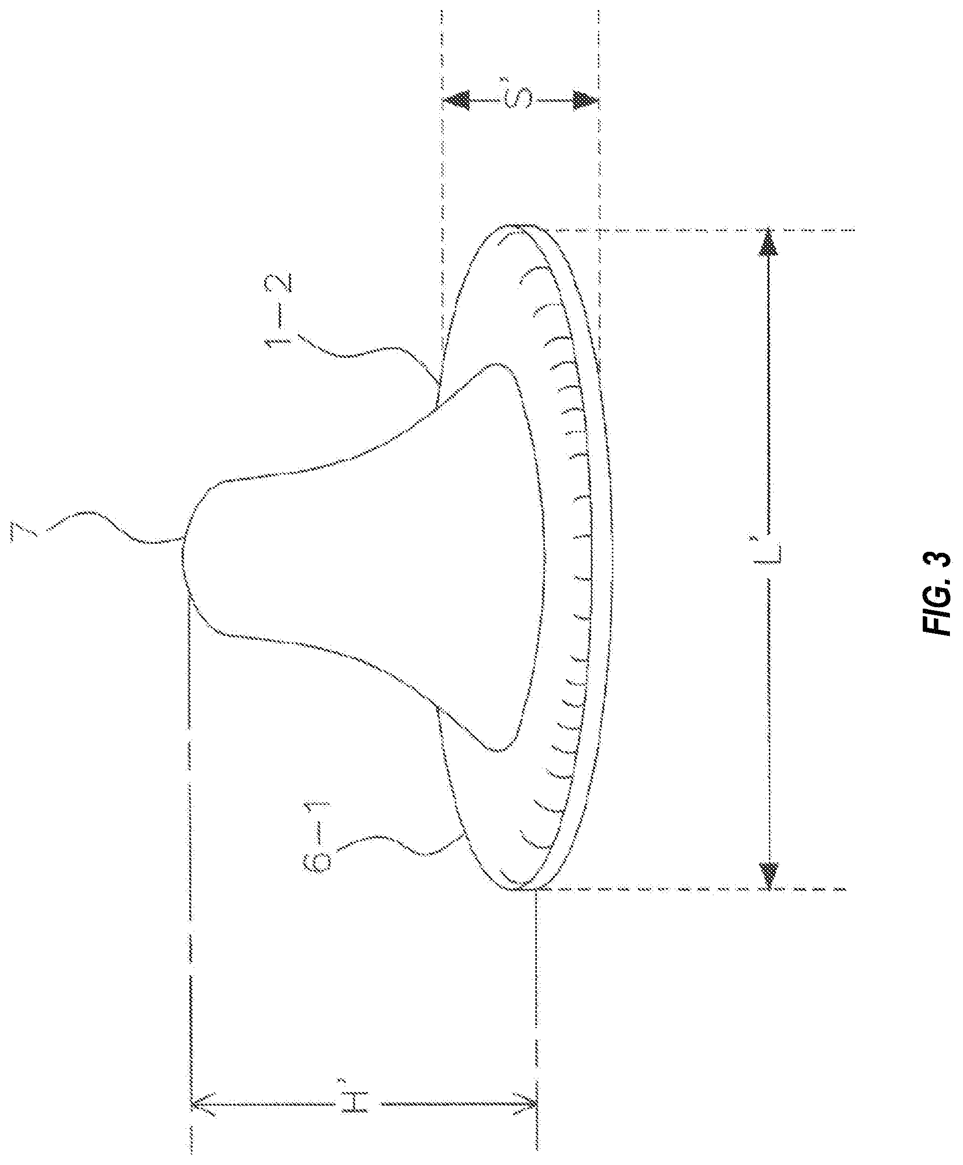 Patent US11772331 Figure 4 – System and method for producing dental solutions incorporating a guidance package