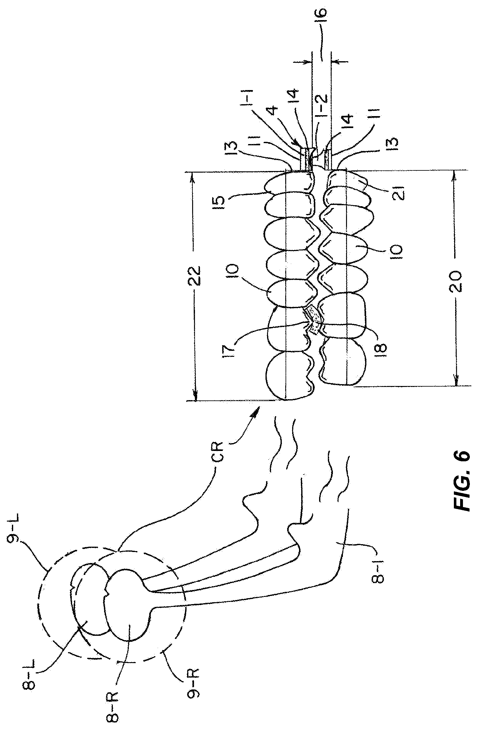 Patent US11772331 Figure 7 – System and method for producing dental solutions incorporating a guidance package