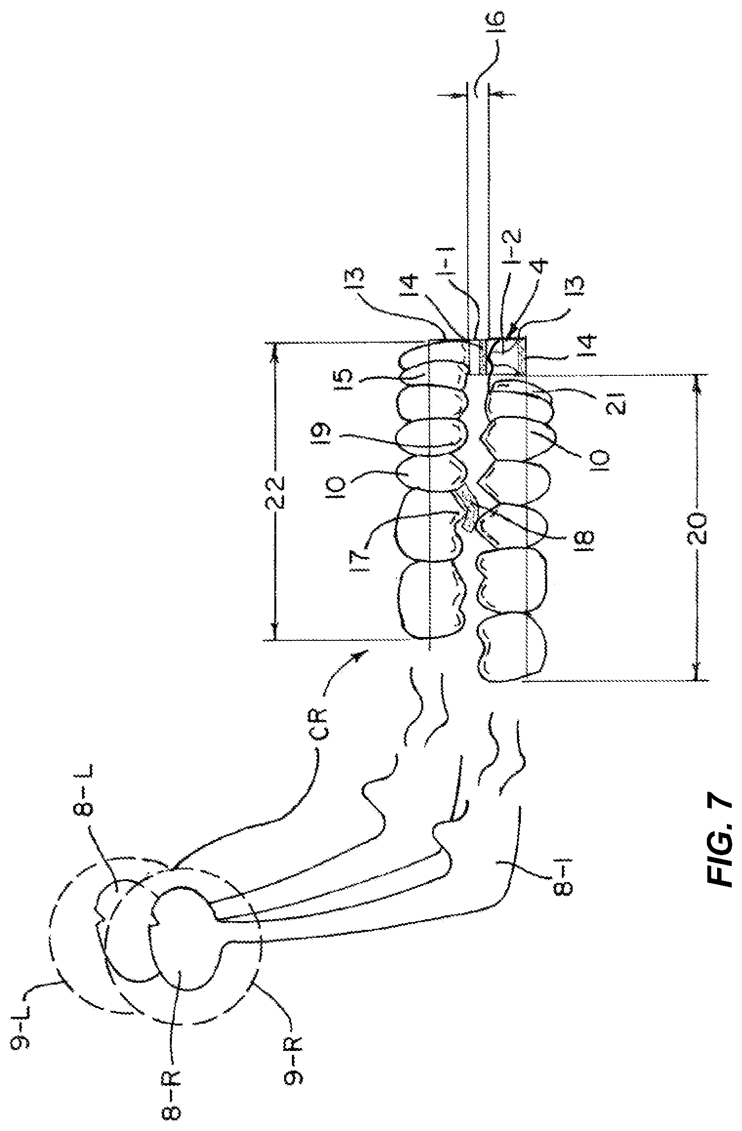 Patent US11772331 Figure 8 – System and method for producing dental solutions incorporating a guidance package