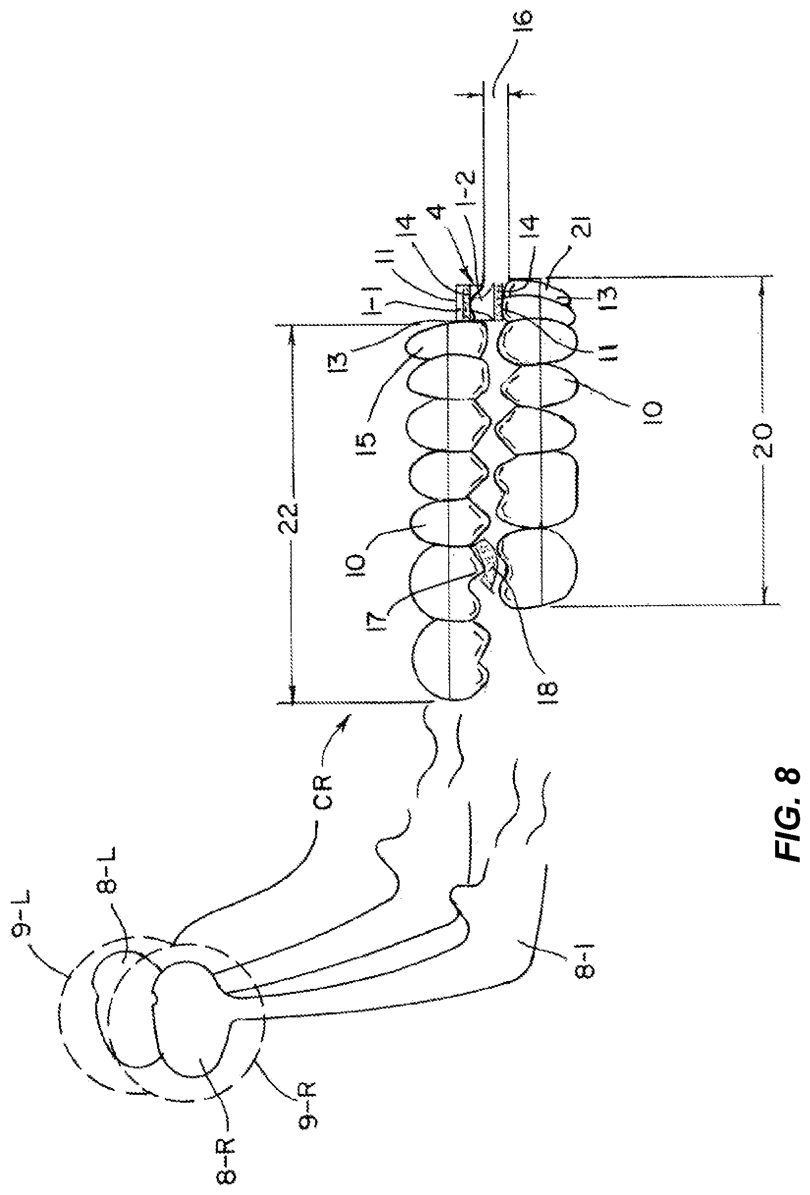 Patent US11772331 Figure 9 – System and method for producing dental solutions incorporating a guidance package