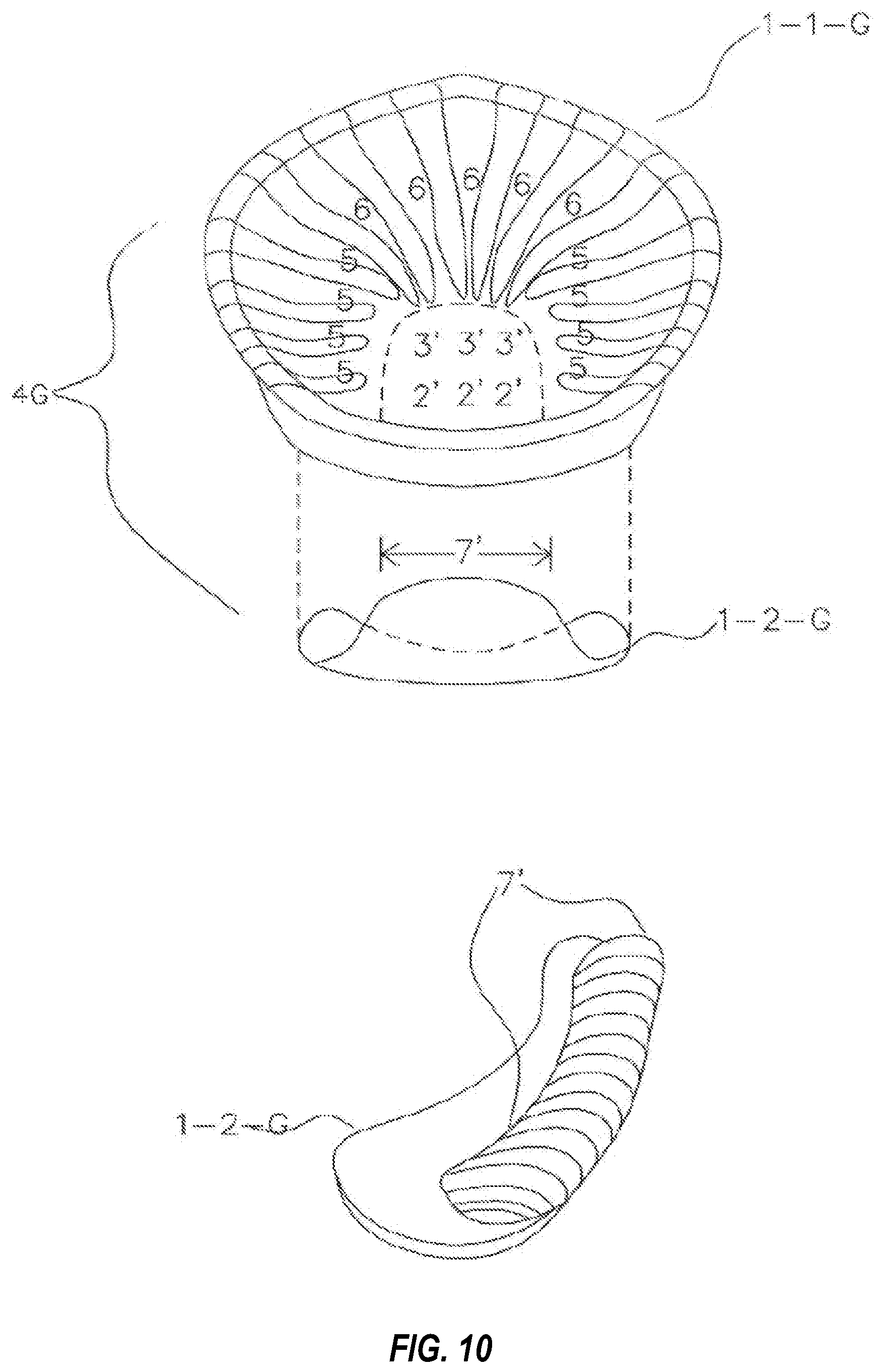Patent US11772331 Figure 11 – System and method for producing dental solutions incorporating a guidance package