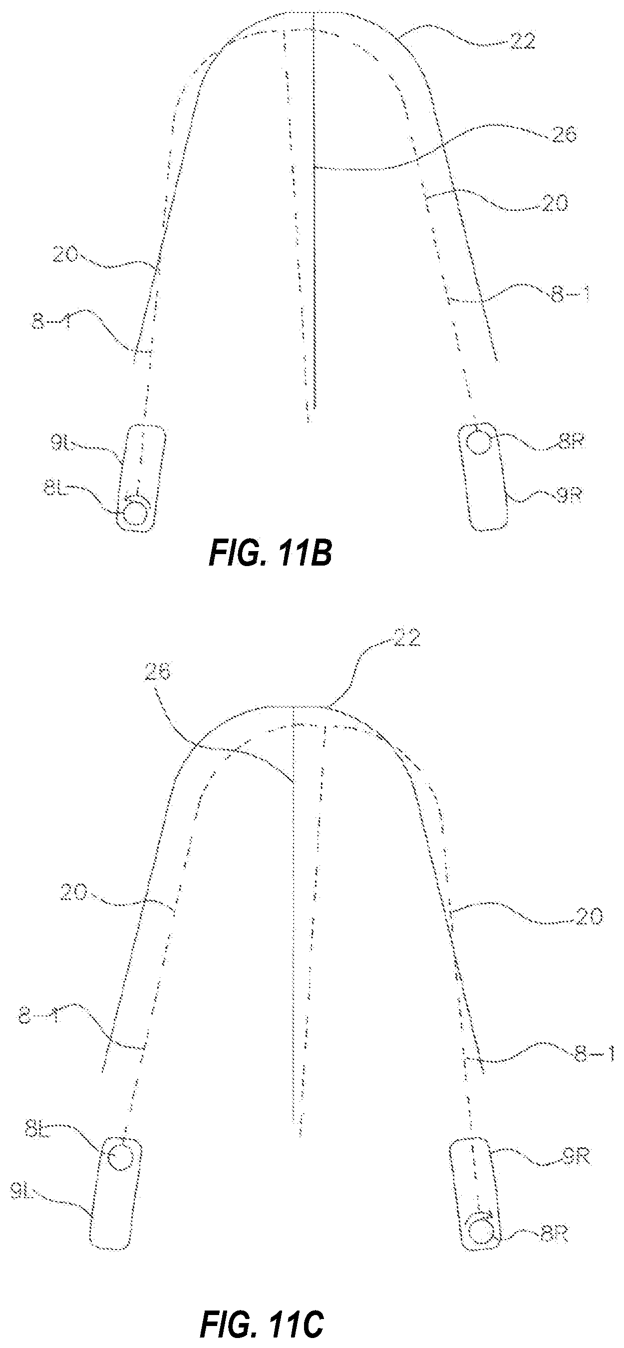 Patent US11772331 Figure 13 – System and method for producing dental solutions incorporating a guidance package