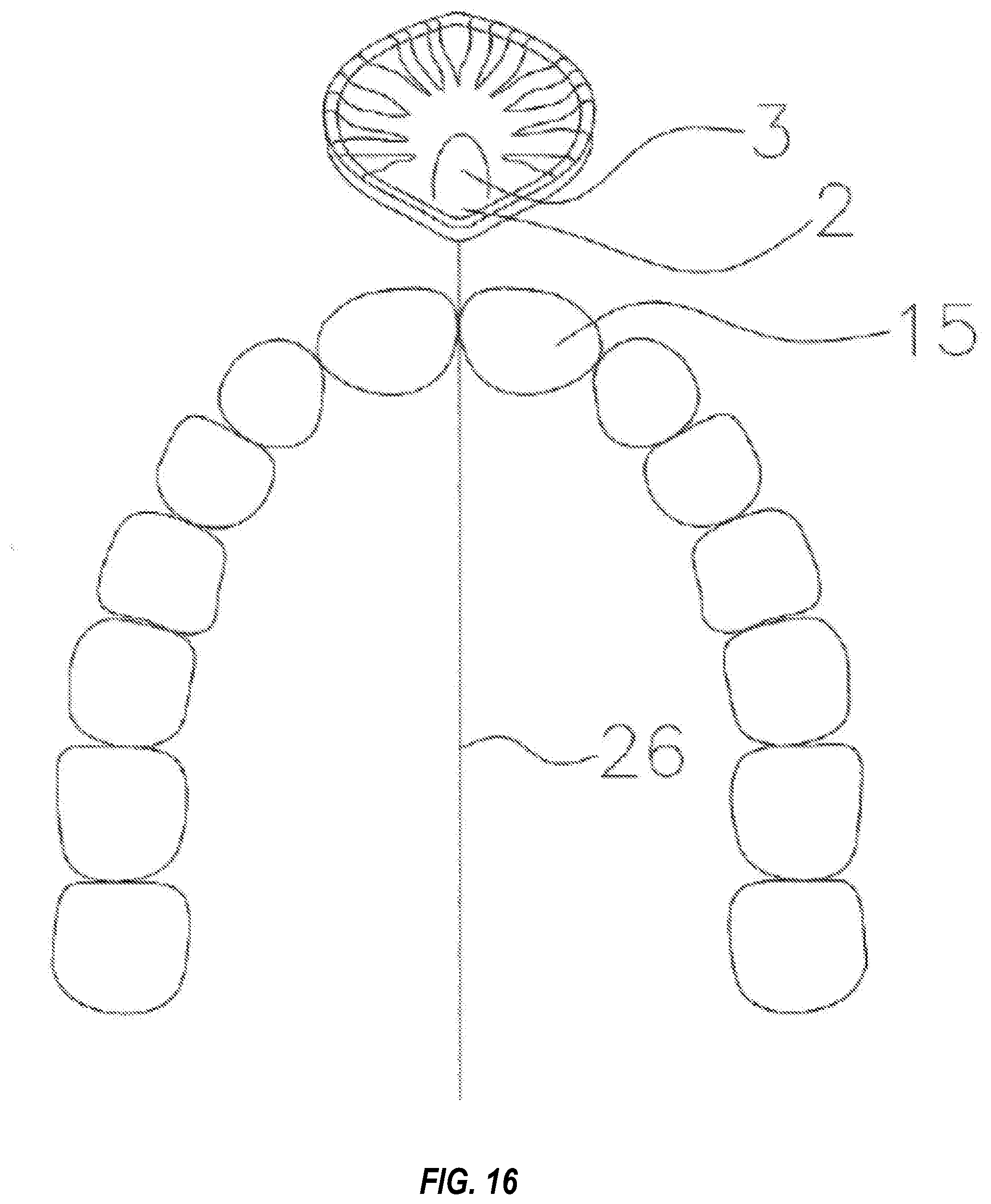 Patent US11772331 Figure 20 – System and method for producing dental solutions incorporating a guidance package