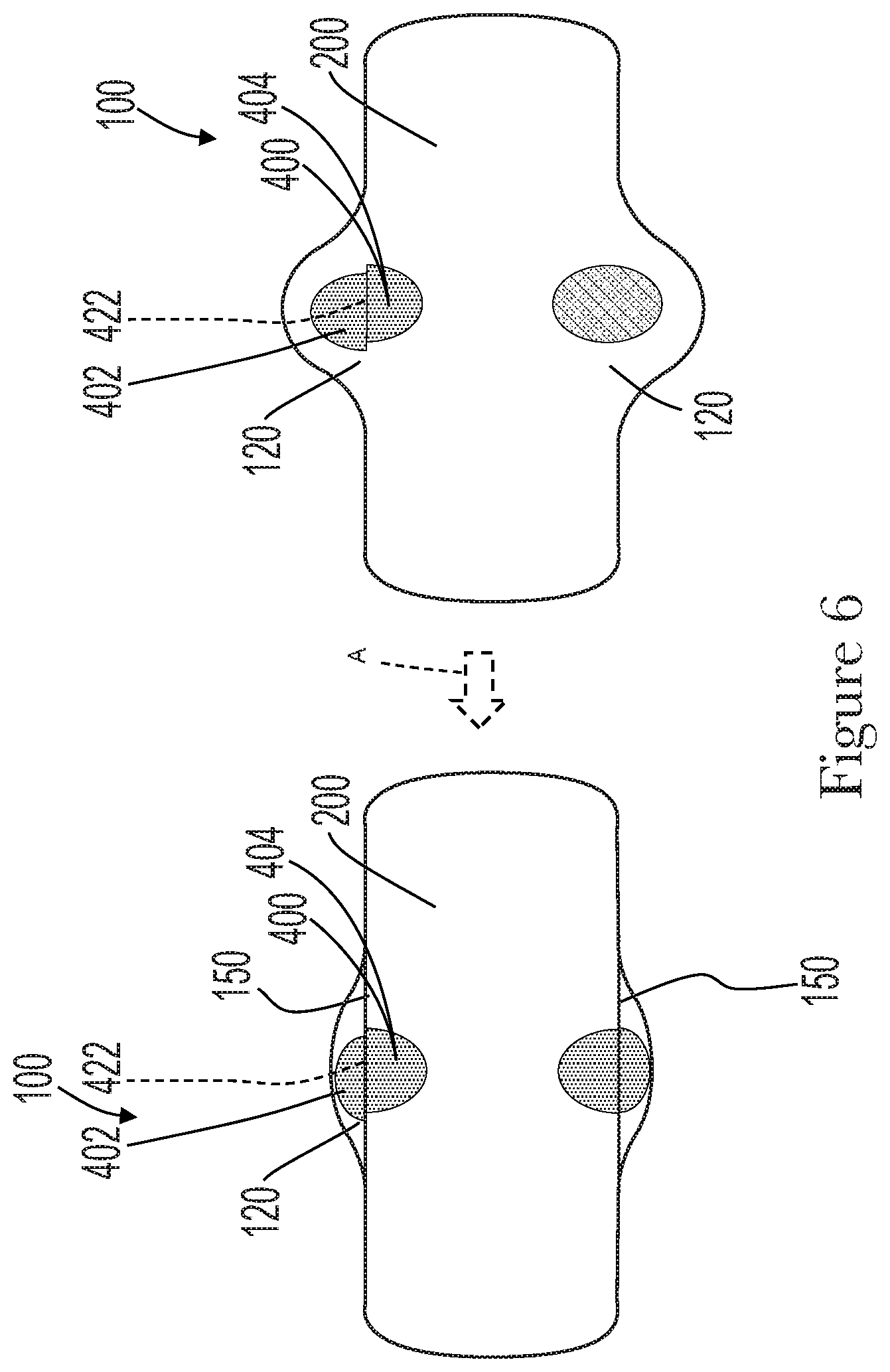 Patent US11772390 Figure 6 – Method and apparatus for inkjet printing absorbent article components