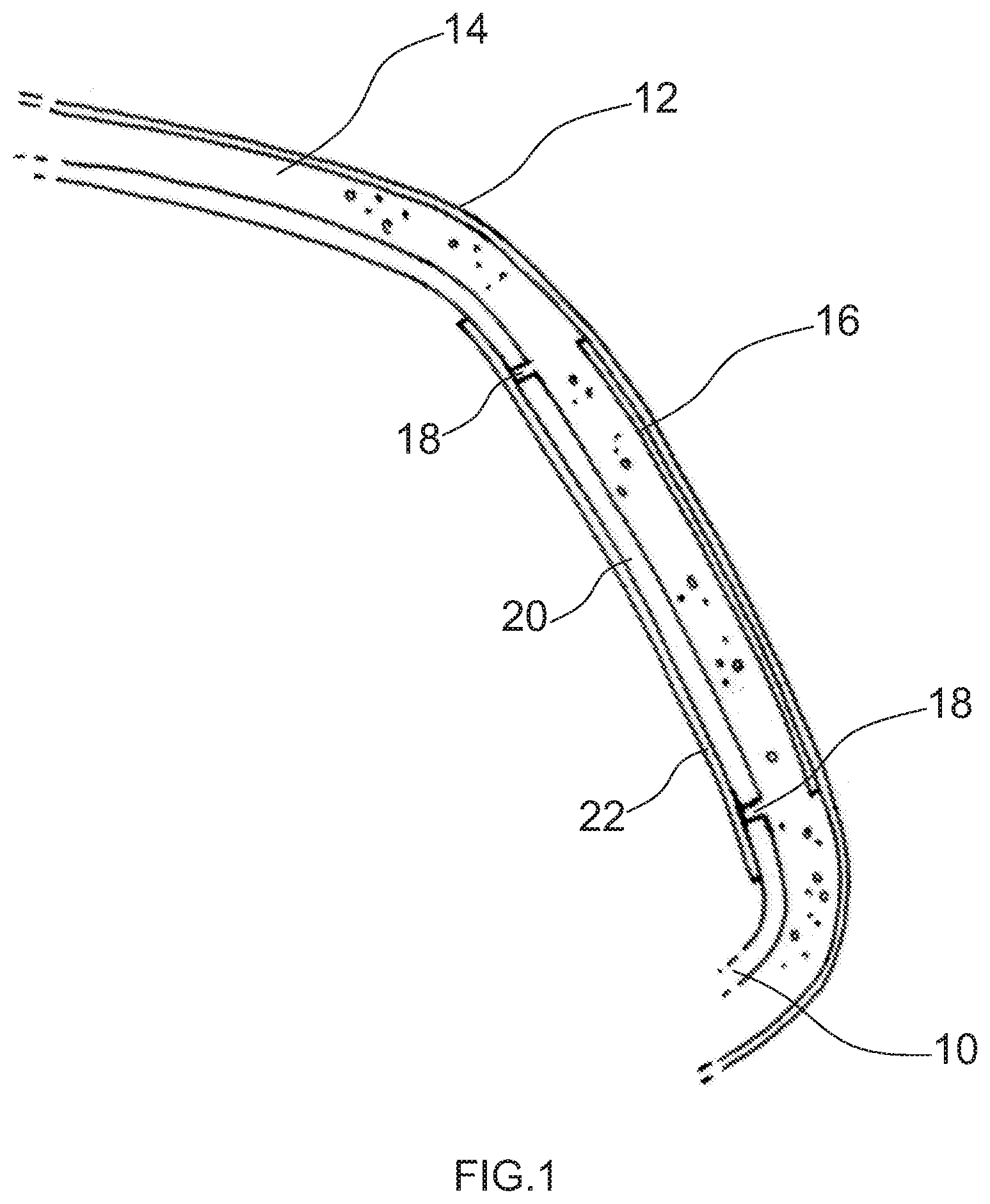 Patent US11772576 Figure 1 – Interior trim part for a motor vehicle and method of its manufacture