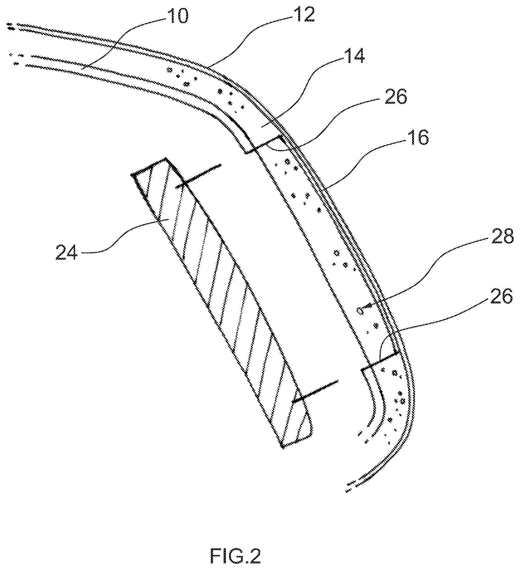 Patent US11772576 Figure 2 – Interior trim part for a motor vehicle and method of its manufacture
