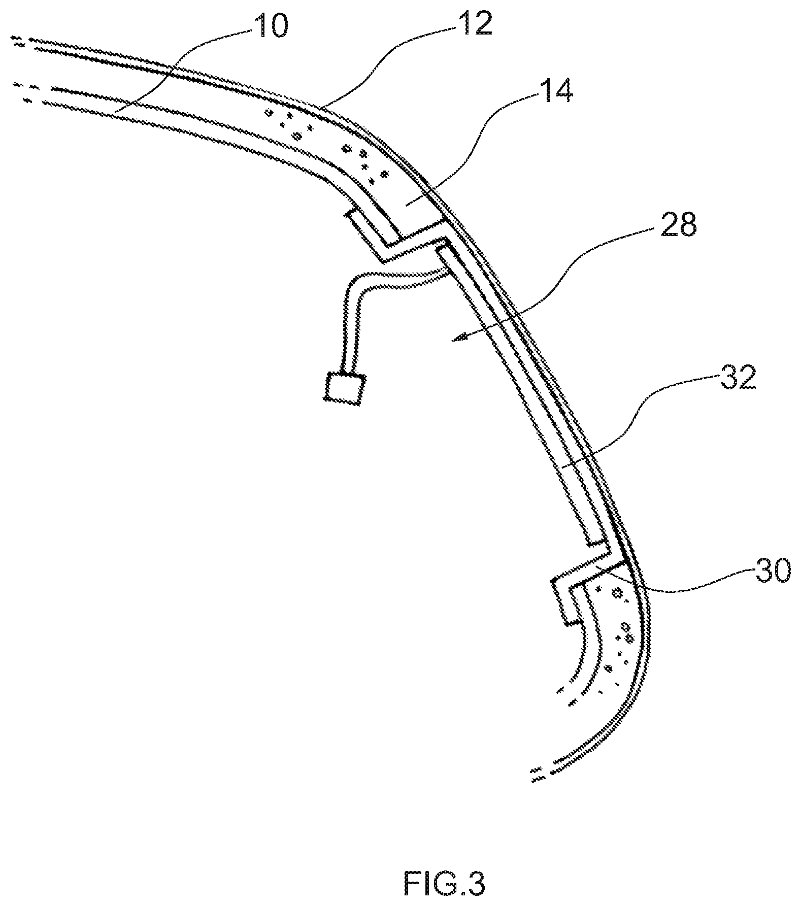 Patent US11772576 Figure 3 – Interior trim part for a motor vehicle and method of its manufacture