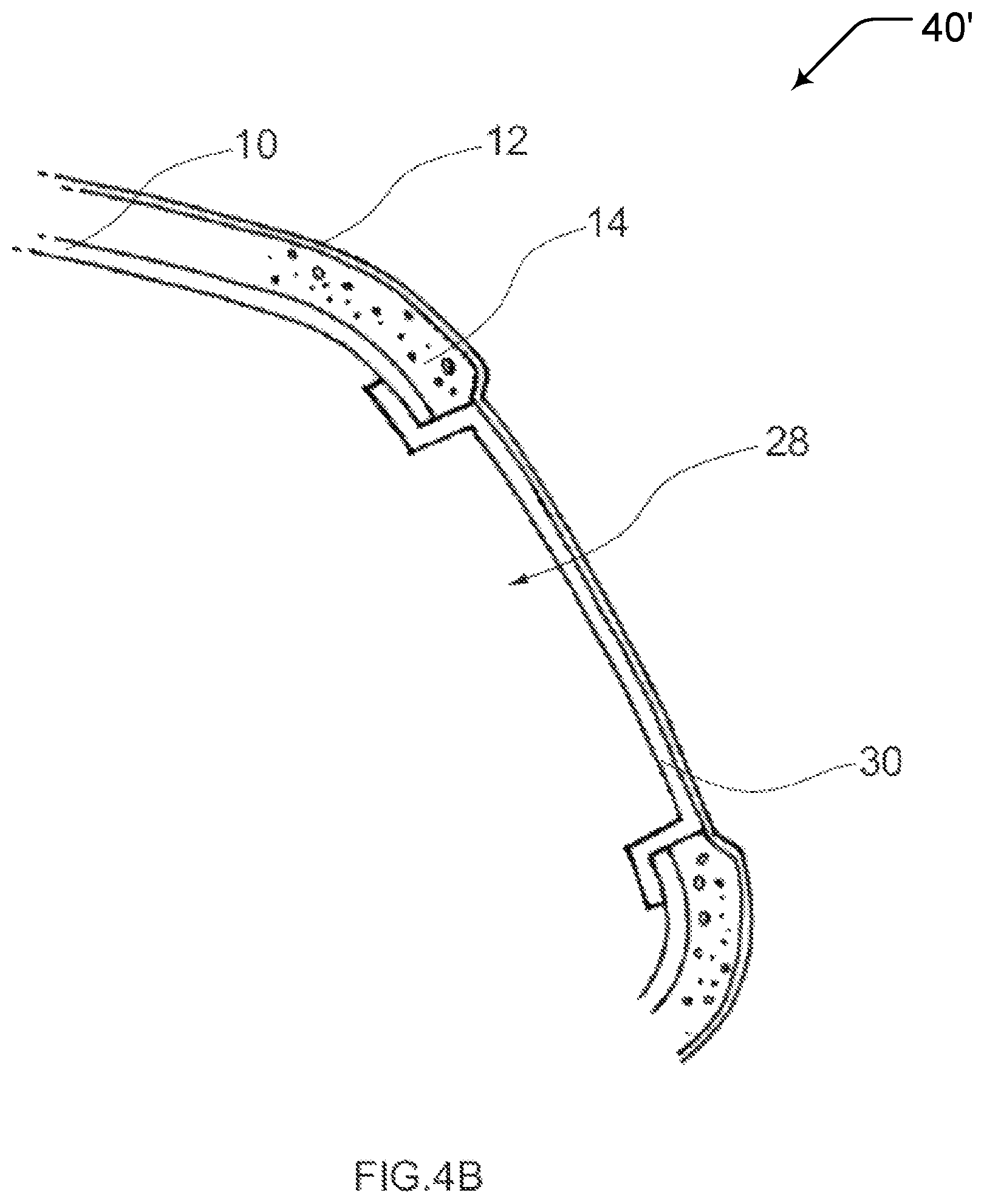 Patent US11772576 Figure 5 – Interior trim part for a motor vehicle and method of its manufacture