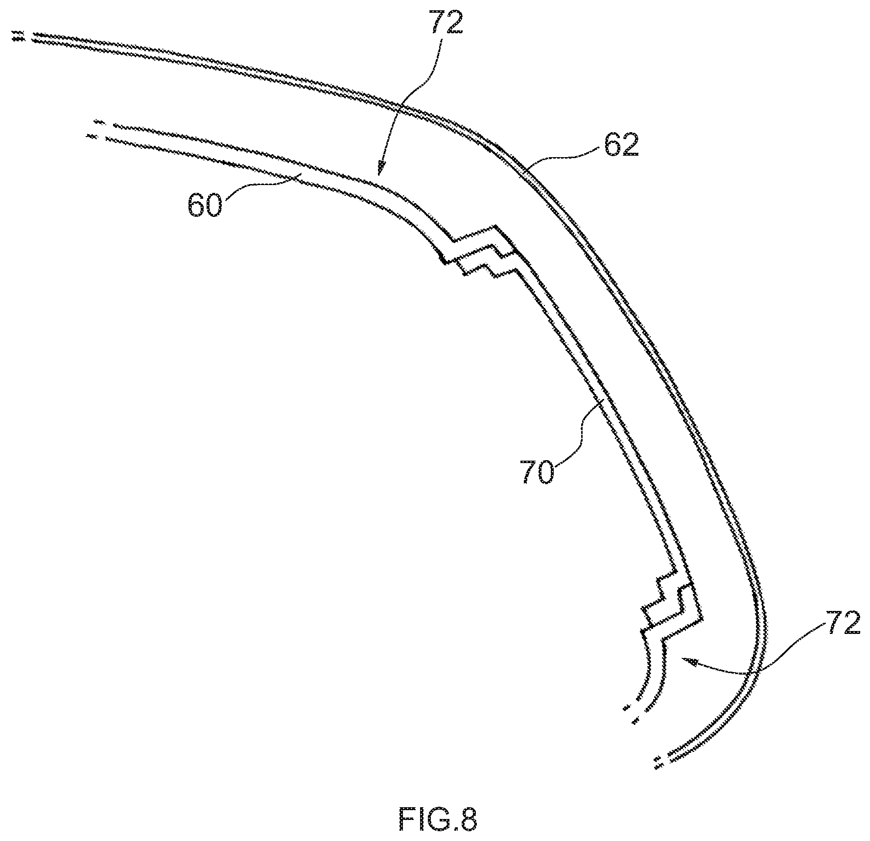 Patent US11772576 Figure 9 – Interior trim part for a motor vehicle and method of its manufacture