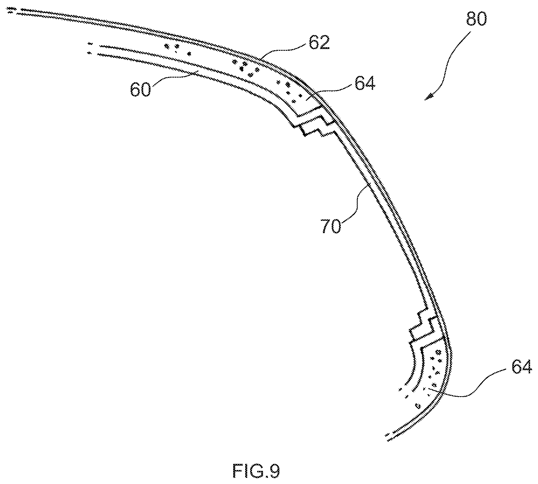 Patent US11772576 Figure 10 – Interior trim part for a motor vehicle and method of its manufacture