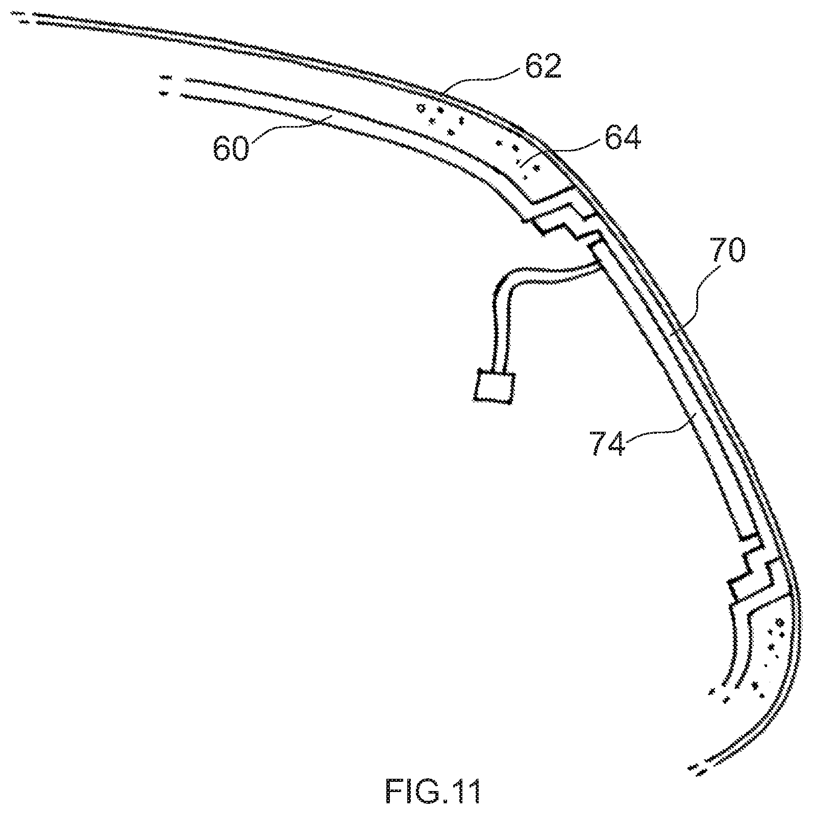 Patent US11772576 Figure 12 – Interior trim part for a motor vehicle and method of its manufacture