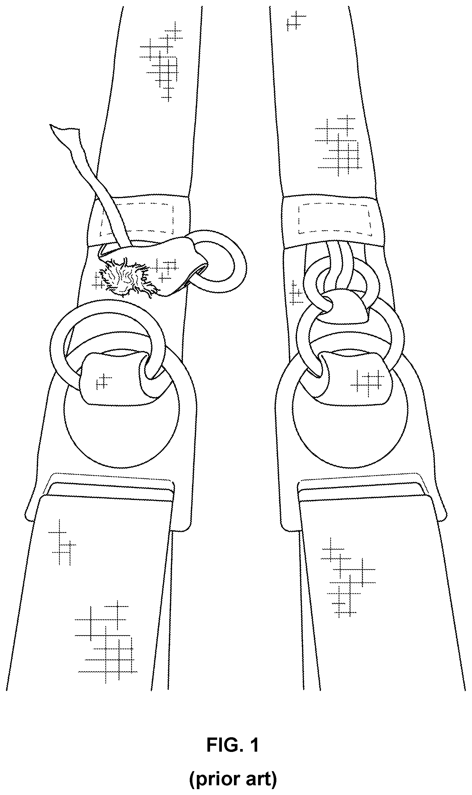 Patent US11772802 Figure 1 – Ring release systems and methods utilizing a removable pin