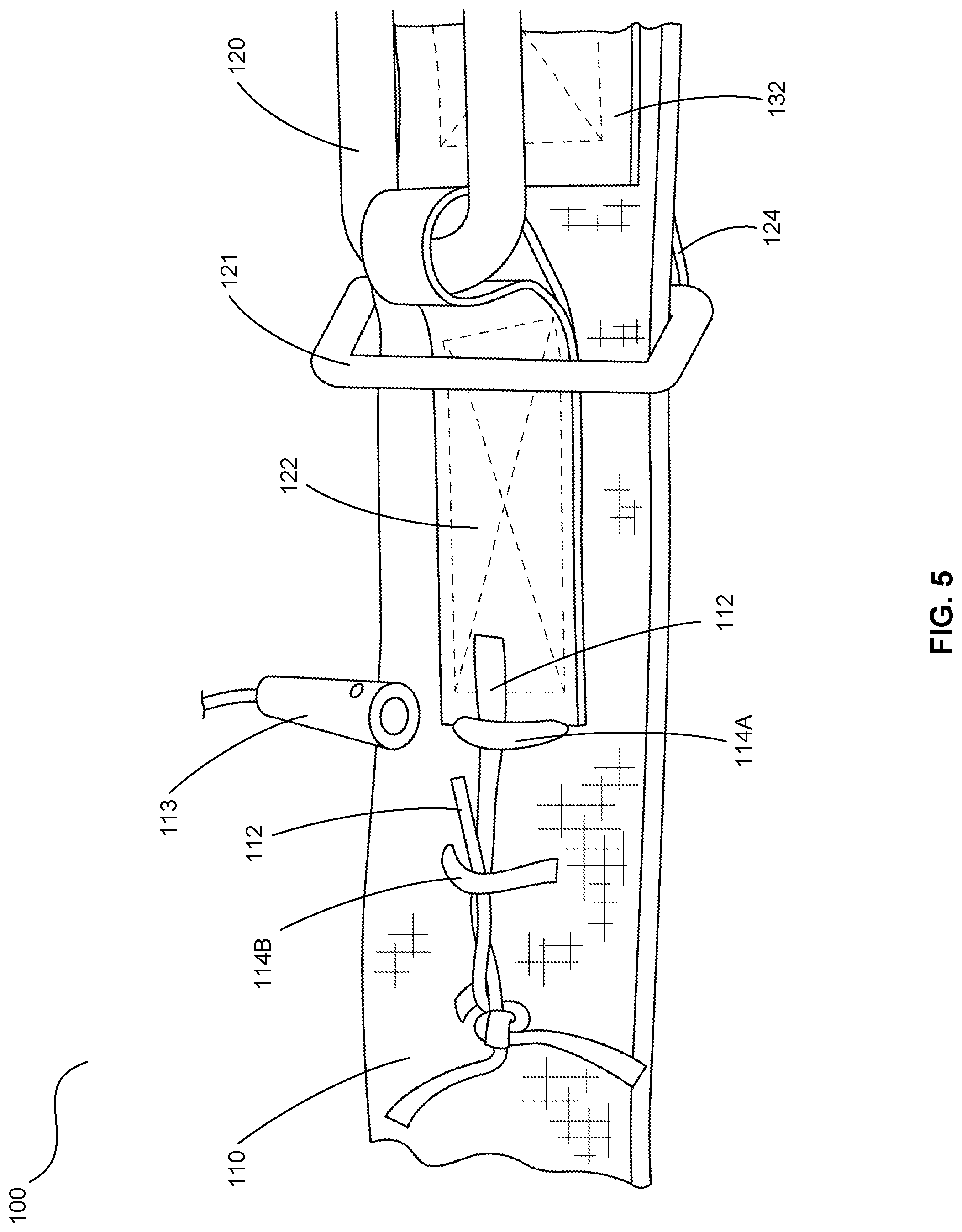 Patent US11772802 Figure 6 – Ring release systems and methods utilizing a removable pin