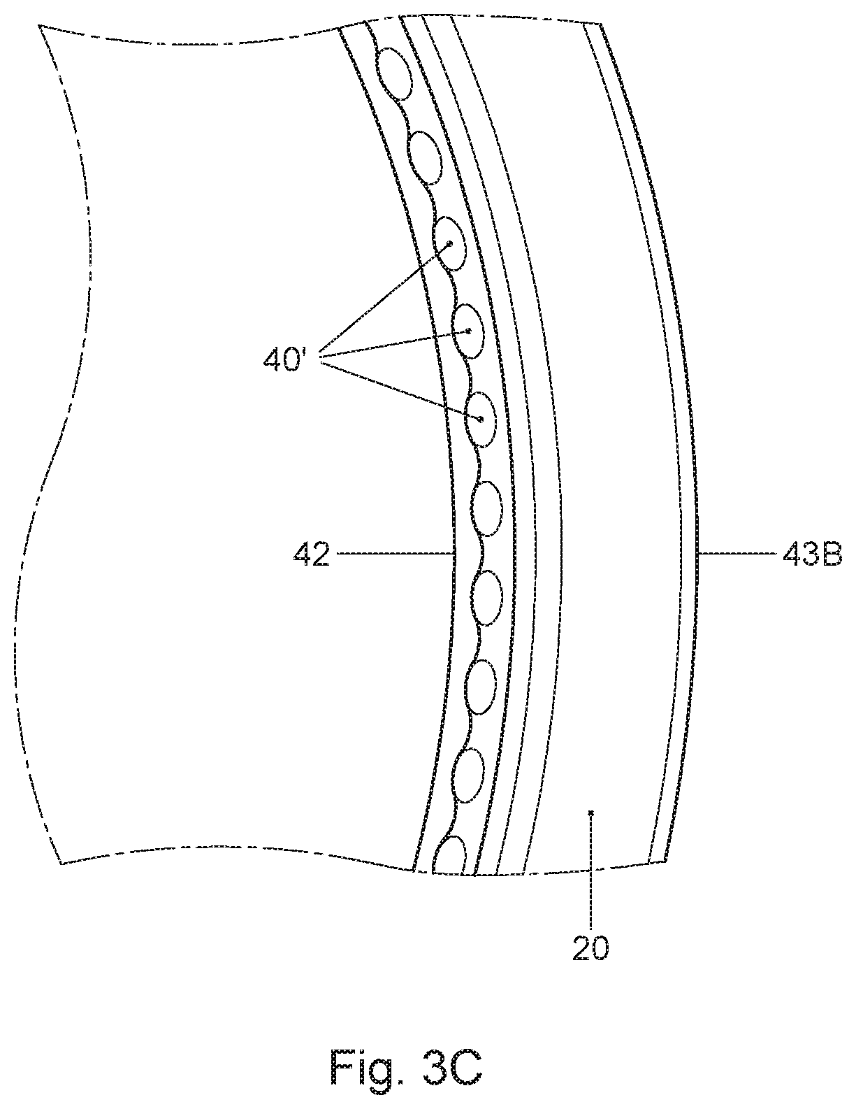 Patent US11772883 Figure 4 – Capsule, a system for preparing a potable beverage from such a capsule and use of such a capsule in a beverage preparation device