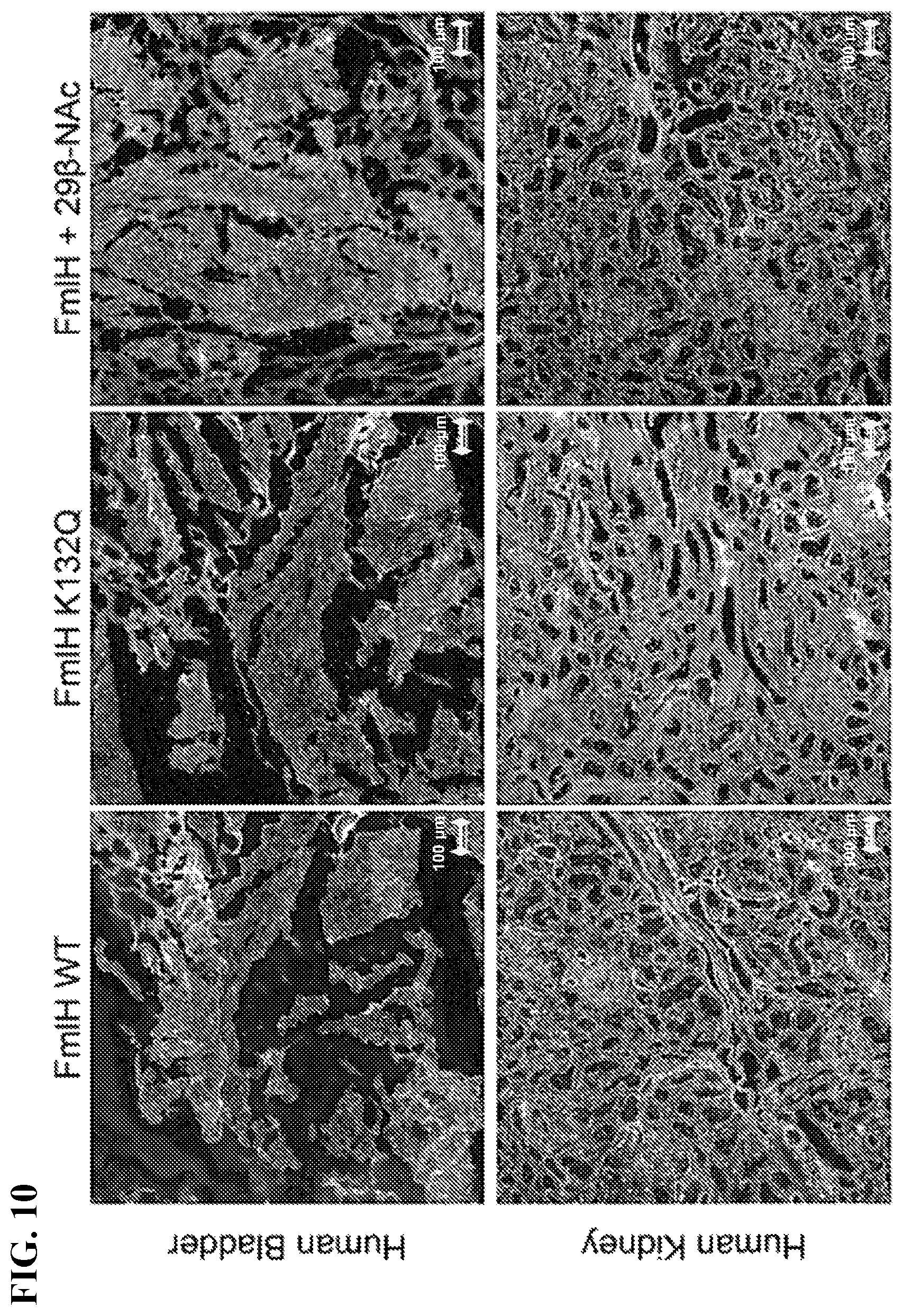 Patent US11773127 Figure 10 – Compounds and methods for treating bacterial infections