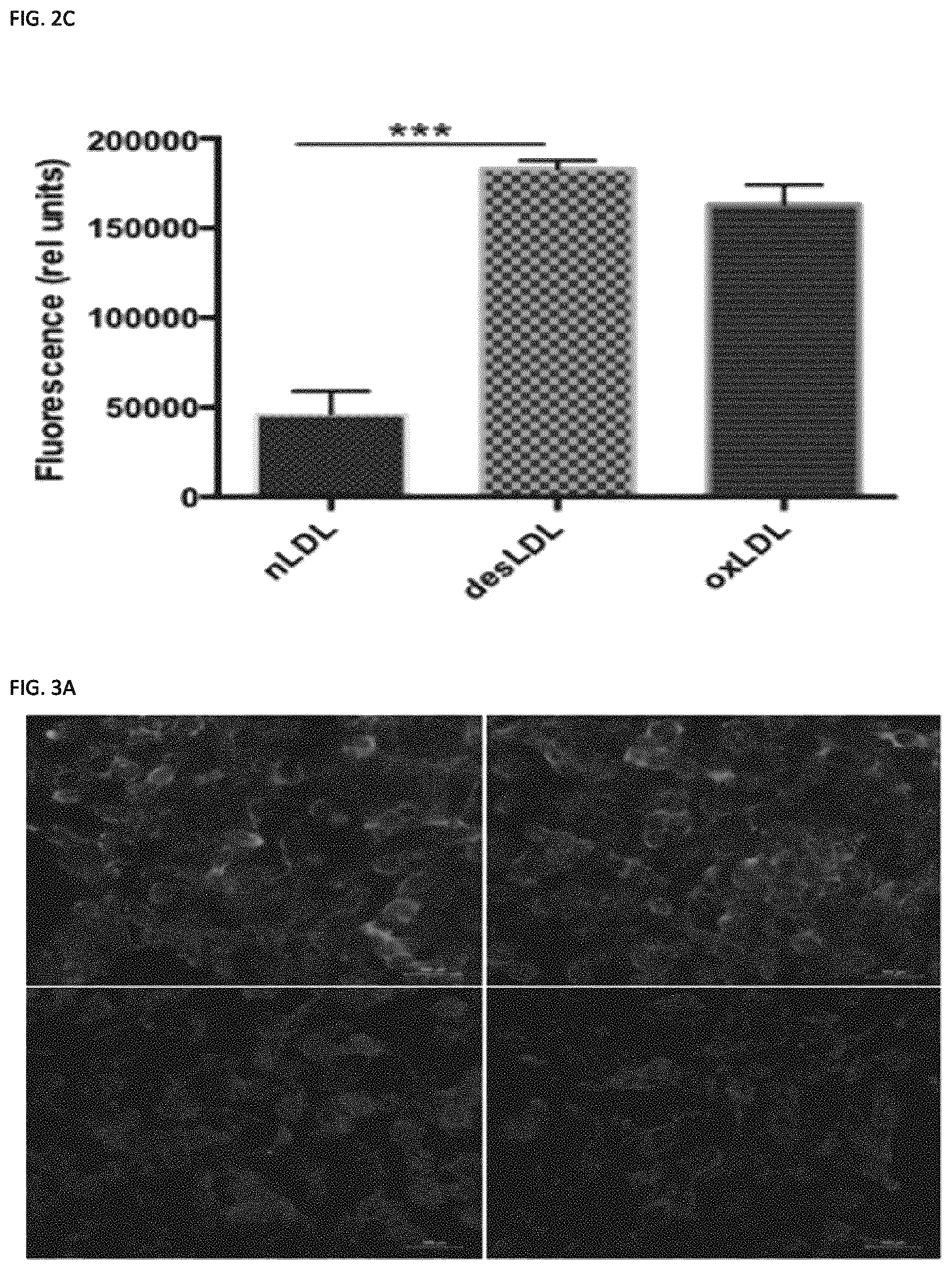 Patent US11773129 Figure 4 – Methods of preventing or treating atherosclerosis with inhibitors of specific isoenzymes of human neuraminidase