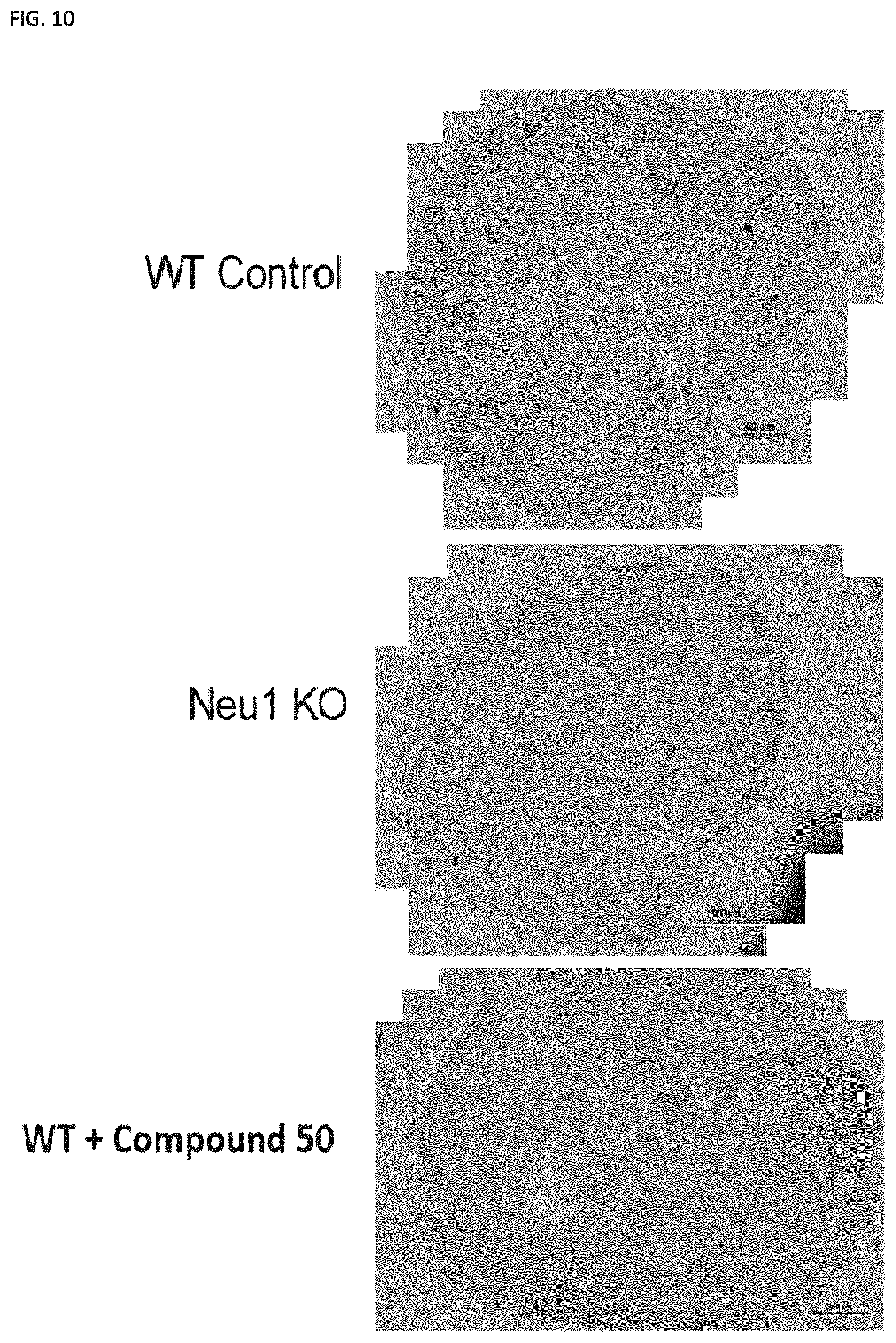 Patent US11773129 Figure 17 – Methods of preventing or treating atherosclerosis with inhibitors of specific isoenzymes of human neuraminidase