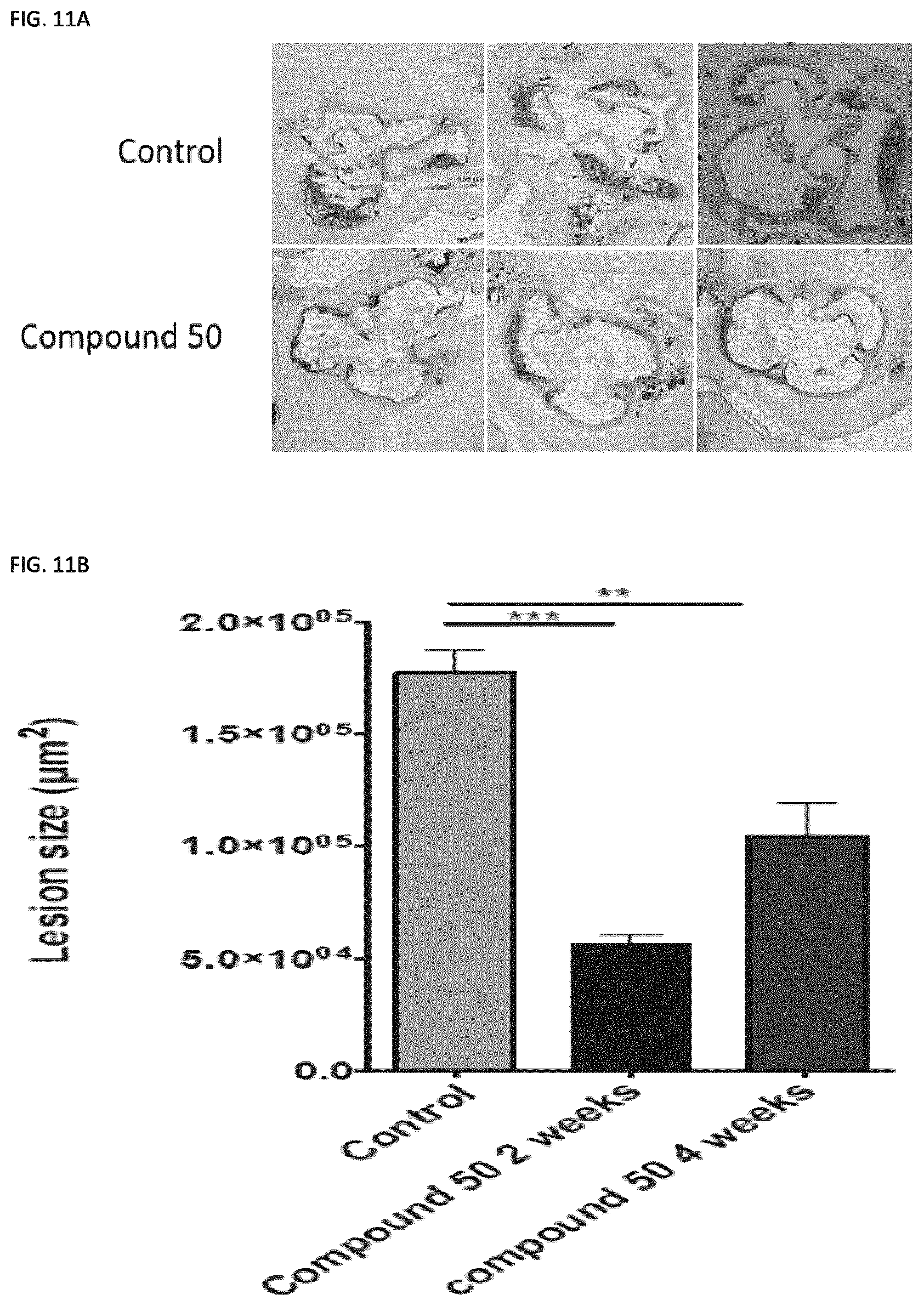 Patent US11773129 Figure 18 – Methods of preventing or treating atherosclerosis with inhibitors of specific isoenzymes of human neuraminidase