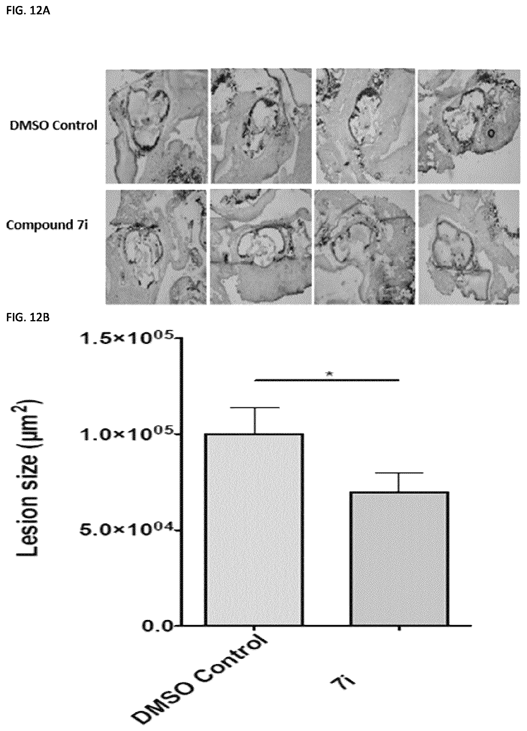 Patent US11773129 Figure 19 – Methods of preventing or treating atherosclerosis with inhibitors of specific isoenzymes of human neuraminidase