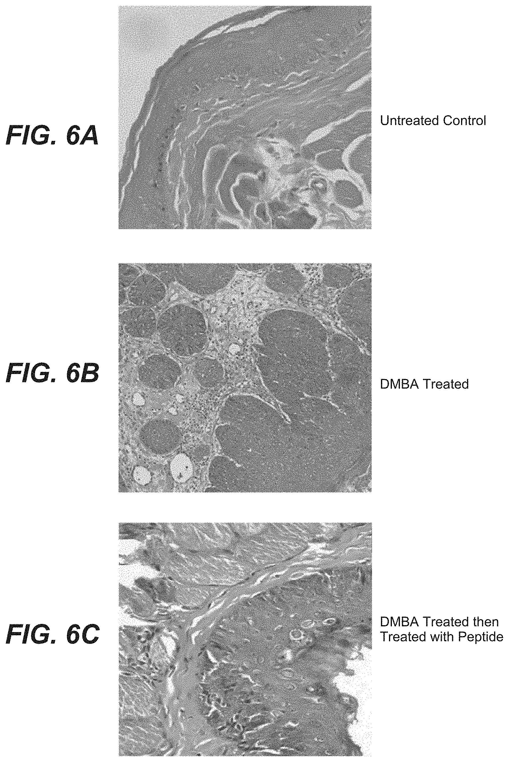 Patent US11773135 Figure 5 – Inhibitors of NF kappa-B activity for treatment of diseases and disorders