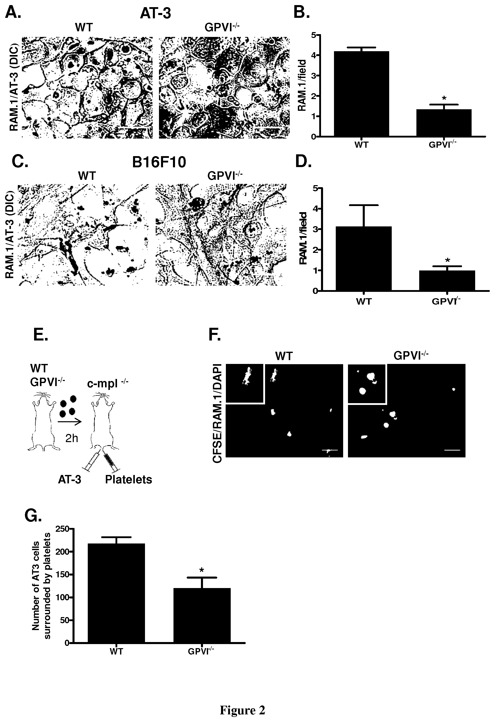 Patent US11773163 Figure 2 – Methods and pharmaceutical compositions for the prophylactic treatment of metastases