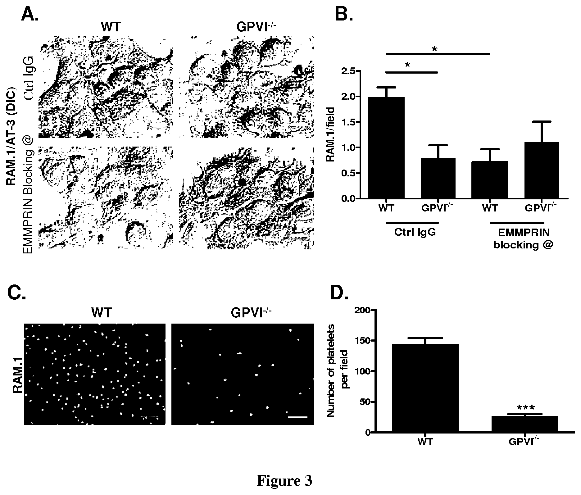 Patent US11773163 Figure 3 – Methods and pharmaceutical compositions for the prophylactic treatment of metastases