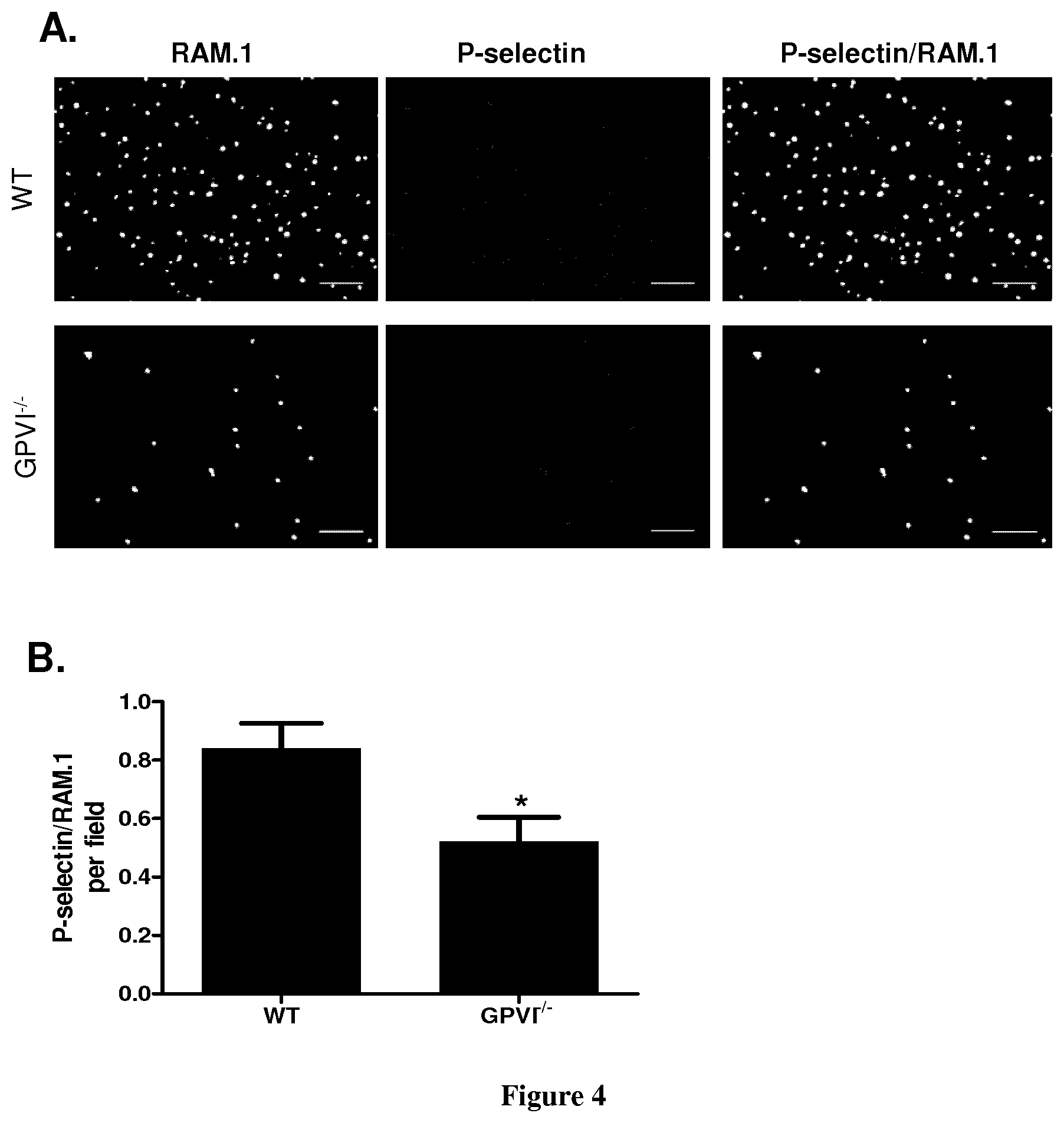 Patent US11773163 Figure 4 – Methods and pharmaceutical compositions for the prophylactic treatment of metastases