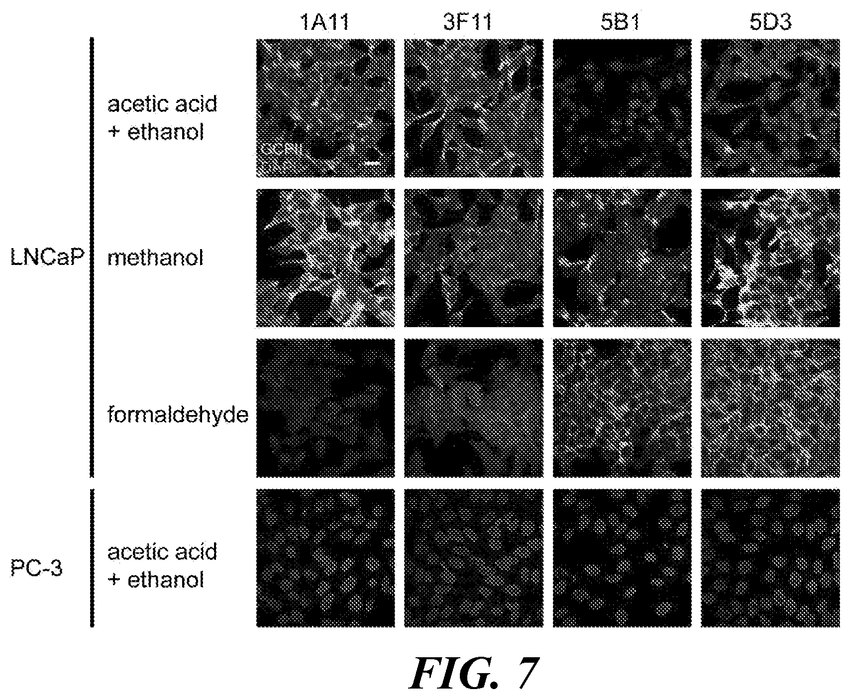Patent US11773182 Figure 7 – Development of new monoclonal antibodies recognizing human prostate-specific membrane antigen (PSMA)