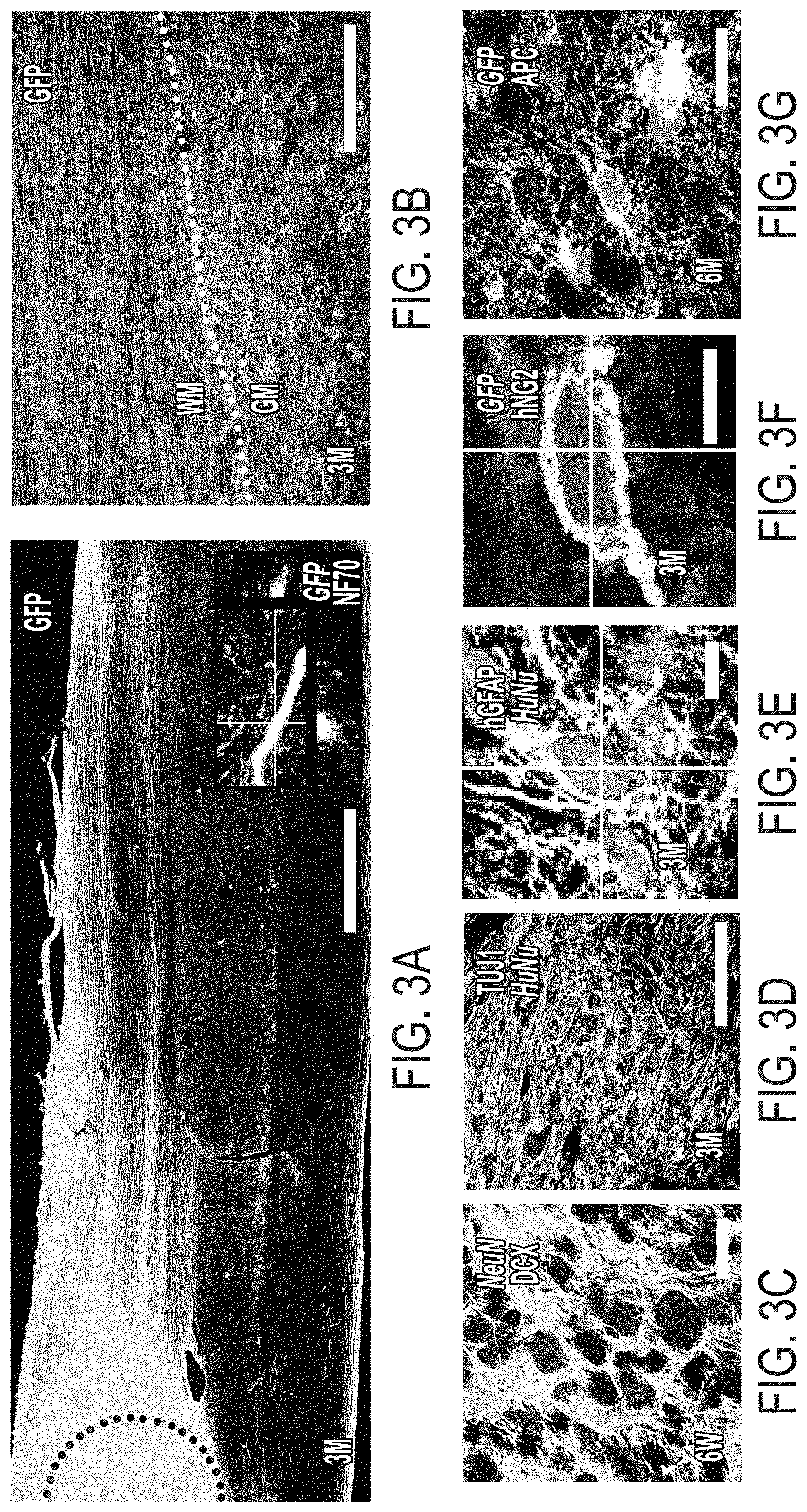 Patent US11773369 Figure 5 – Generation of human spinal cord neural stem cells