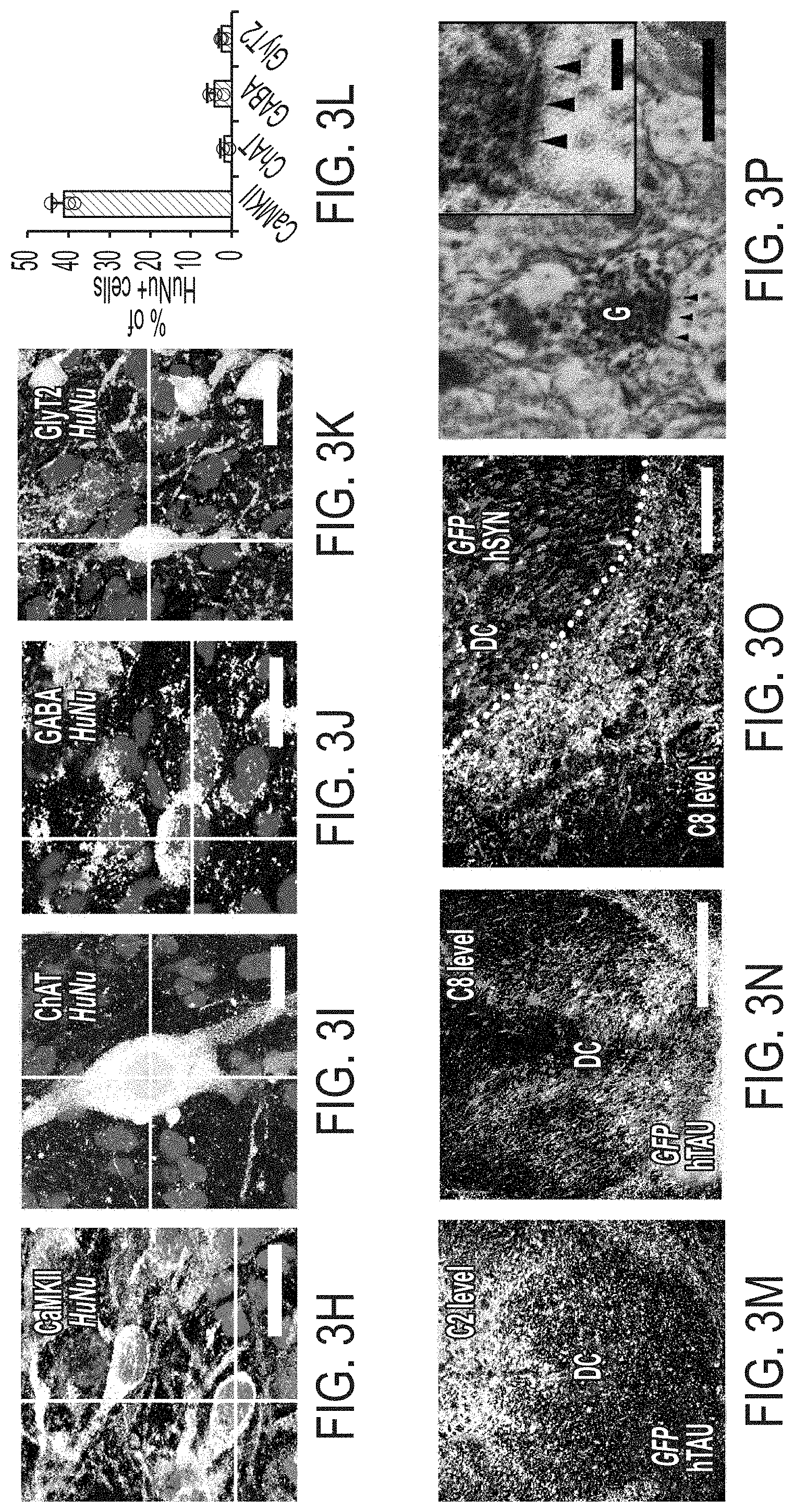 Patent US11773369 Figure 6 – Generation of human spinal cord neural stem cells